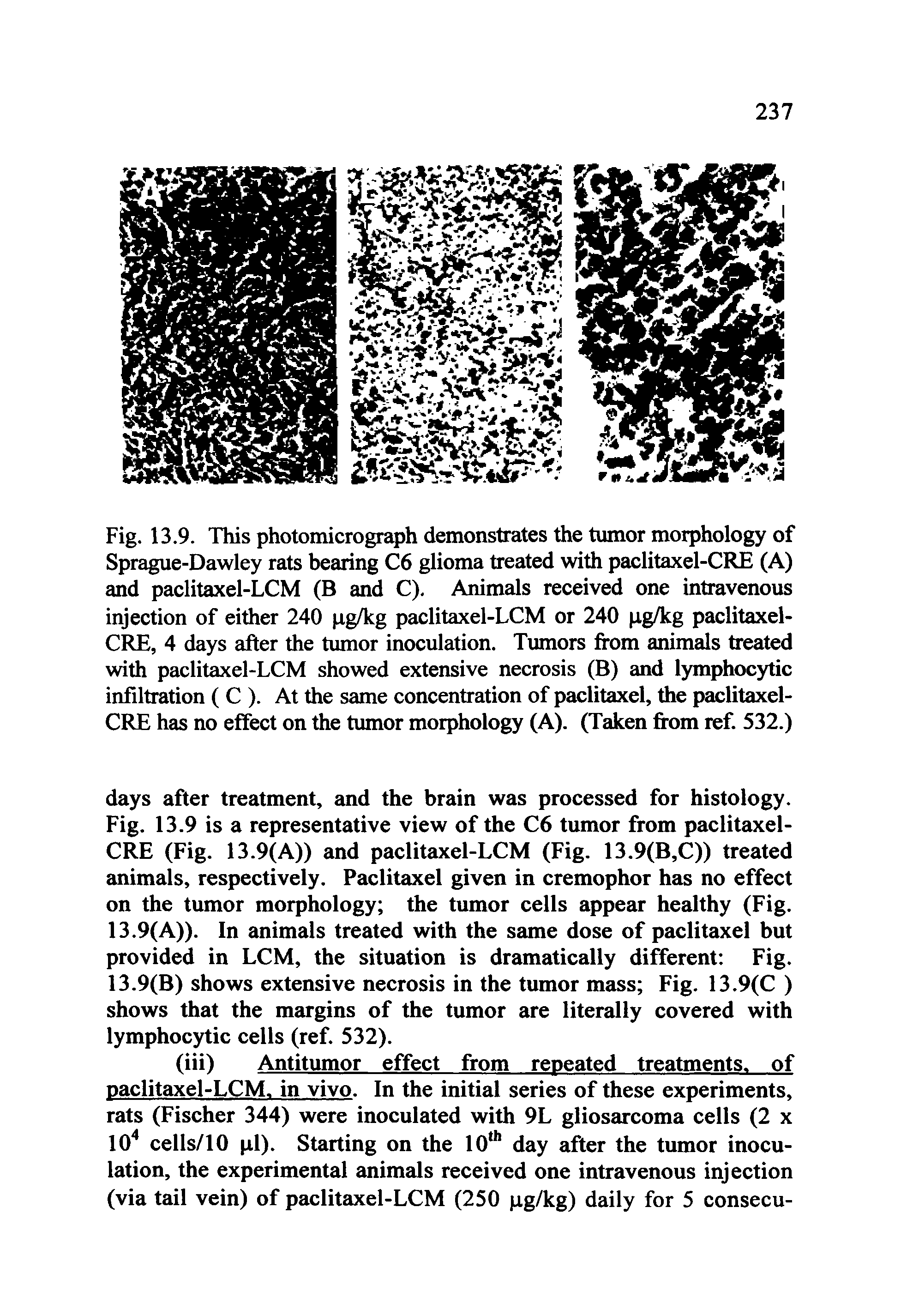 Fig. 13.9. This photomicrograph demonstrates the tumor morphology of Sprague-Dawley rats bearing C6 glioma treated with paclitaxel-CRE (A) and paclitaxel-LCM (B and C). Animals received one intravenous injection of either 240 pg/kg paclitaxel-LCM or 240 pg/kg paclitaxel-CRE, 4 days after the tumor inoculation. Tumors from animals treated with paclitaxel-LCM showed extensive necrosis (B) and lymphocytic infiltration ( C ). At the same concentration of paclitaxel, the paclitaxel-CRE has no effect on the tumor morphology (A). (Taken from ref. 532.)...