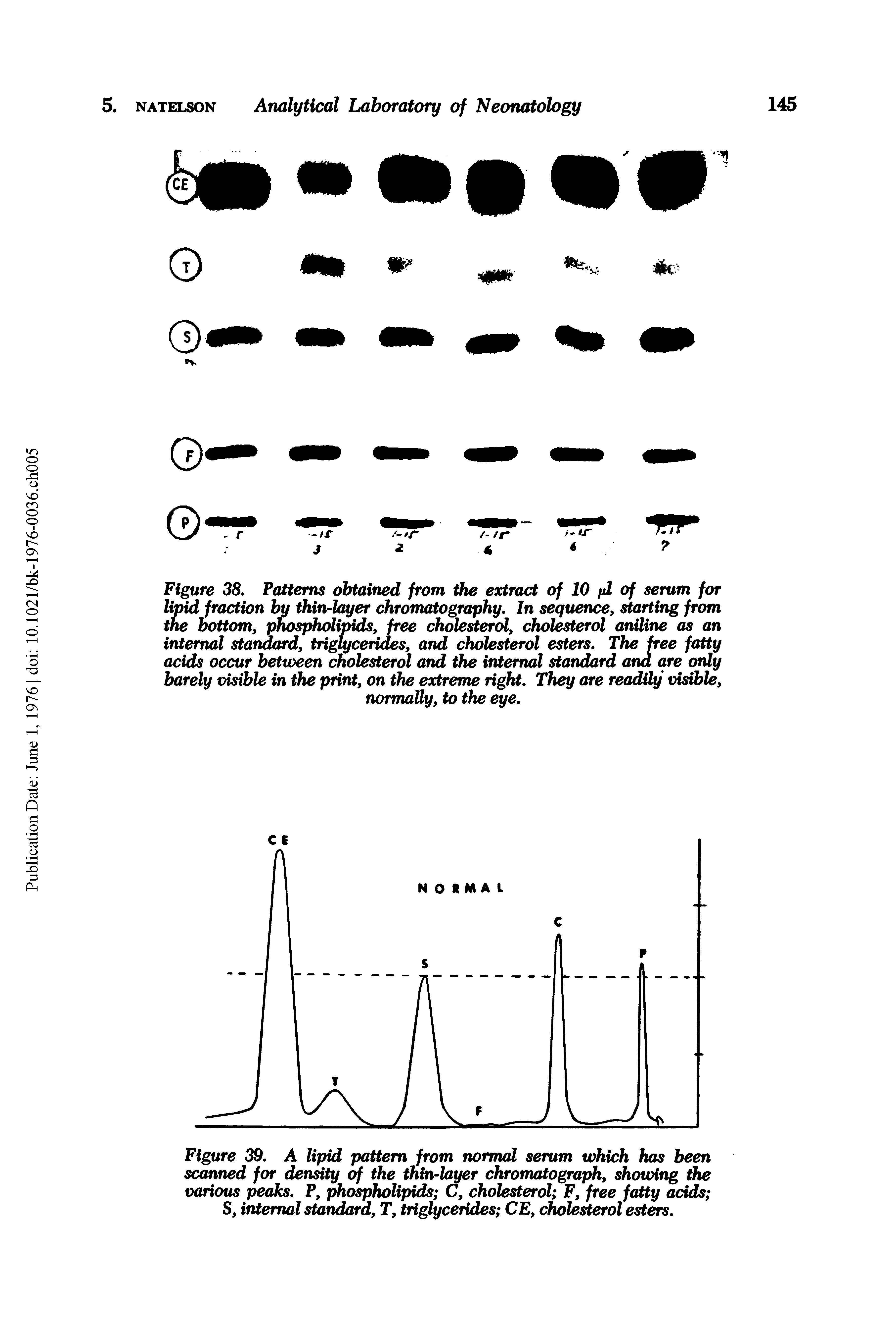 Figure 38, Patterns obtained from the extract of 10 fd of serum for lipid fraction by thin-layer chromatography. In sequence, starting from the bottom, phospholipids, pee cholesterol, cholesterol aniline as an internal standard, triglycerides, and cholesterol esters. The free fatty acids occur between cholesterol and the internal standard and are only barely visible in the print, on the extreme right. They are readily visible, normally, to the eye.