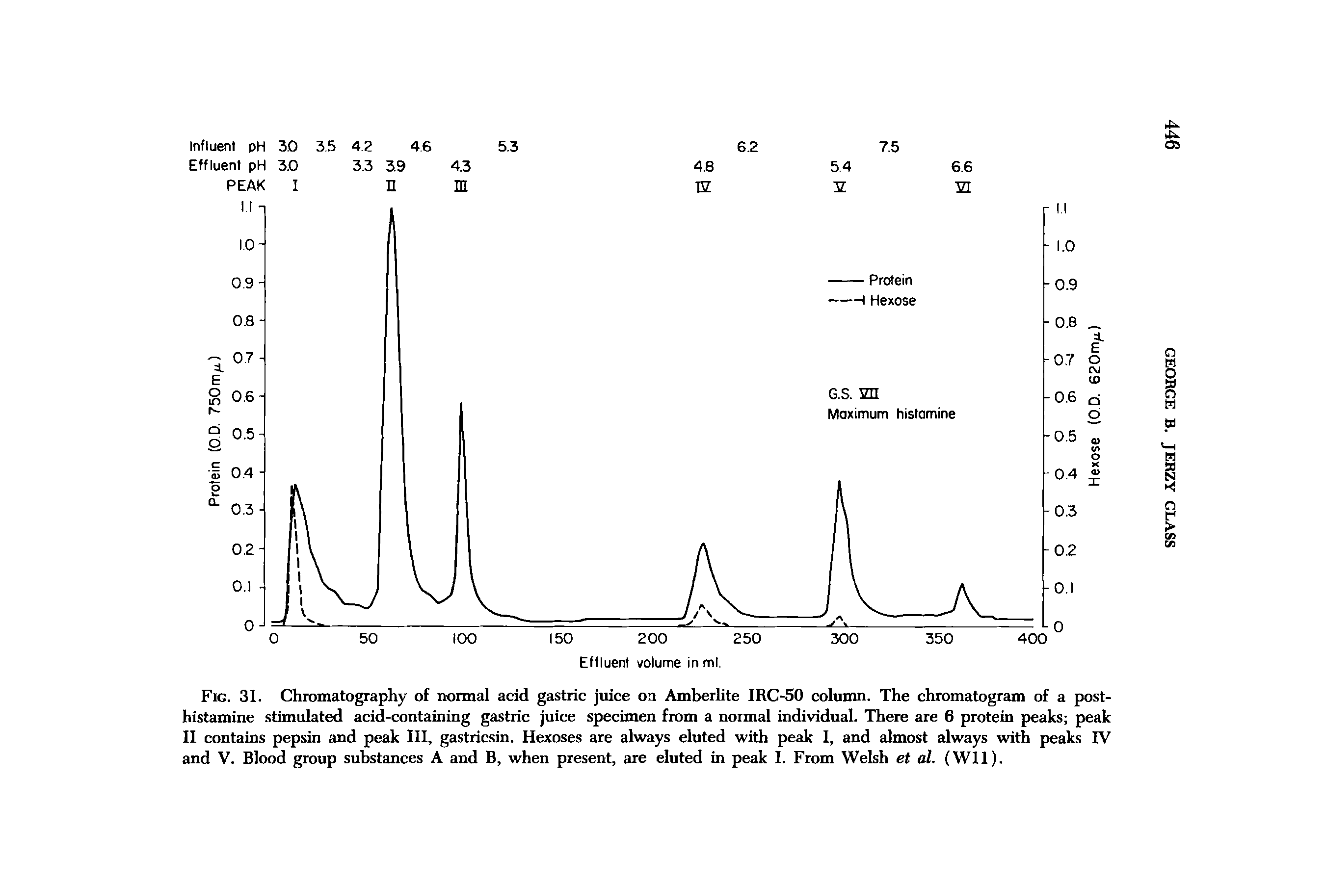 Fig. 31. Chromatography of normal acid gastric juice oa Amberhte IRC-50 column. The chromatogram of a posthistamine stimulated acid-containing gastric juice specimen from a normal individual. There are 6 protein peaks peak II contains pepsin and peak III, gastricsin. Hexoses are always eluted with peak I, and almost always with peaks IV and V. Blood group substances A and B, when present, are eluted in peak I. From Welsh et al. (Wll).