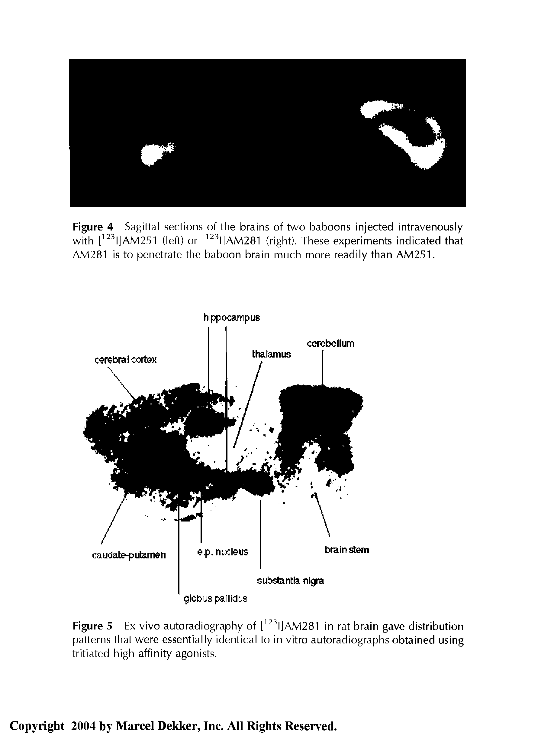 Figure 5 Ex vivo autoradiography of [123I]AM281 in rat brain gave distribution patterns that were essentially identical to in vitro autoradiographs obtained using tritiated high affinity agonists.