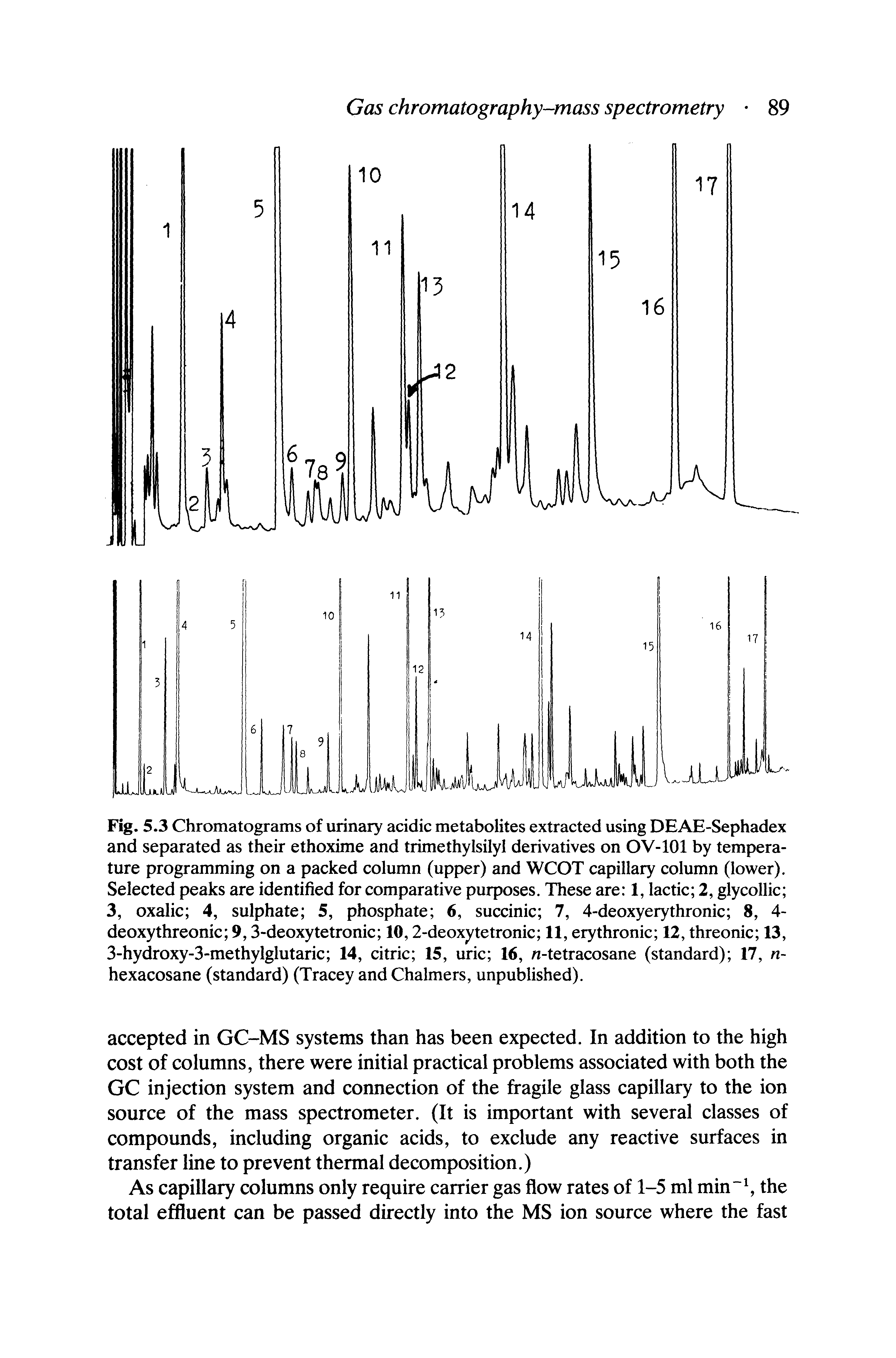 Fig. 5.3 Chromatograms of urinary acidic metabolites extracted using DEAE-Sephadex and separated as their ethoxime and trimethylsilyl derivatives on OV-101 by temperature programming on a packed column (upper) and WCOT capillary column (lower). Selected peaks are identified for comparative purposes. These are 1, lactic 2, glycollic 3, oxalic 4, sulphate 5, phosphate 6, succinic 7, 4-deoxyerythronic 8, 4-deoxythreonic 9,3-deoxytetronic 10,2-deoxytetronic 11, erythronic 12, threonic 13, 3-hydroxy-3-methylglutaric 14, citric 15, uric 16, n-tetracosane (standard) 17, n-hexacosane (standard) (Tracey and Chalmers, unpublished).
