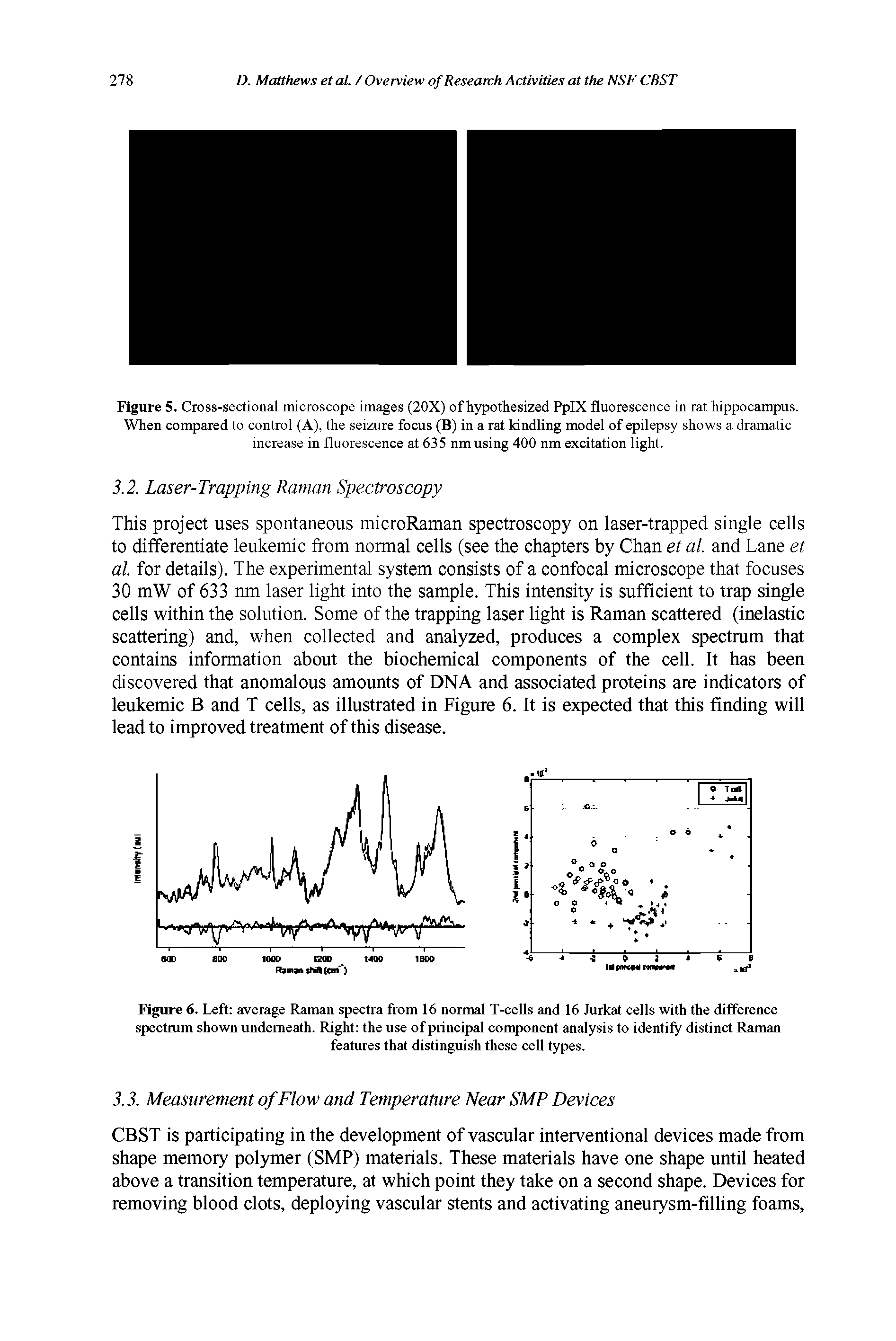 Figure 5. Cross-sectional microscope images (20X) of hypothesized PpIX fluorescence in rat hippocampus. When compared to control (A), the seizure focus (B) in a rat kindling model of epilepsy shows a dramatic increase in fluorescence at 635 nm using 400 nm excitation light.