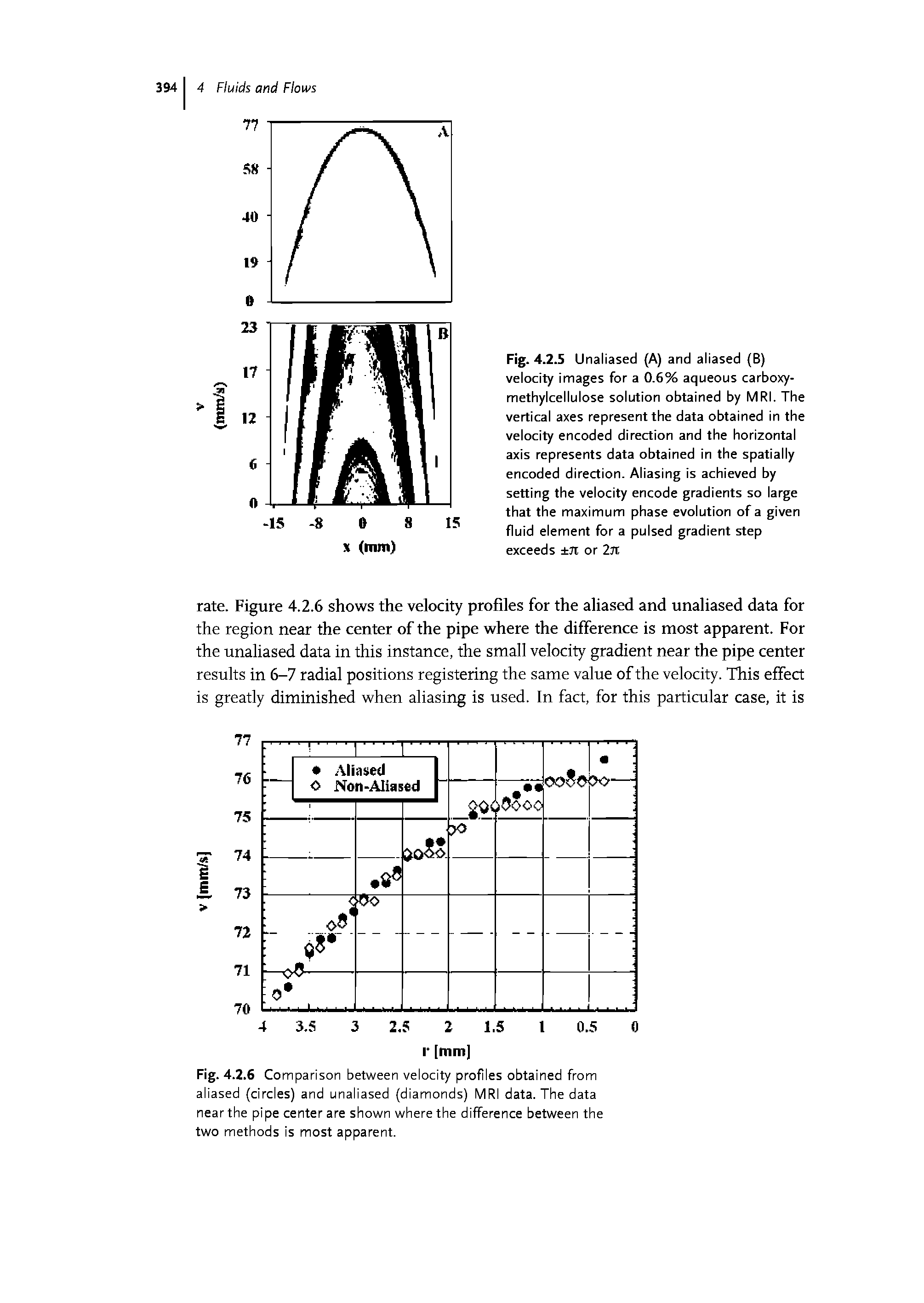 Fig. 4.2.5 Unaliased (A) and aliased (B) velocity images for a 0.6% aqueous carboxy-methylcellulose solution obtained by MRI. The vertical axes represent the data obtained in the velocity encoded direction and the horizontal axis represents data obtained in the spatially encoded direction. Aliasing is achieved by setting the velocity encode gradients so large that the maximum phase evolution of a given fluid element for a pulsed gradient step exceeds Ji or 2jt...