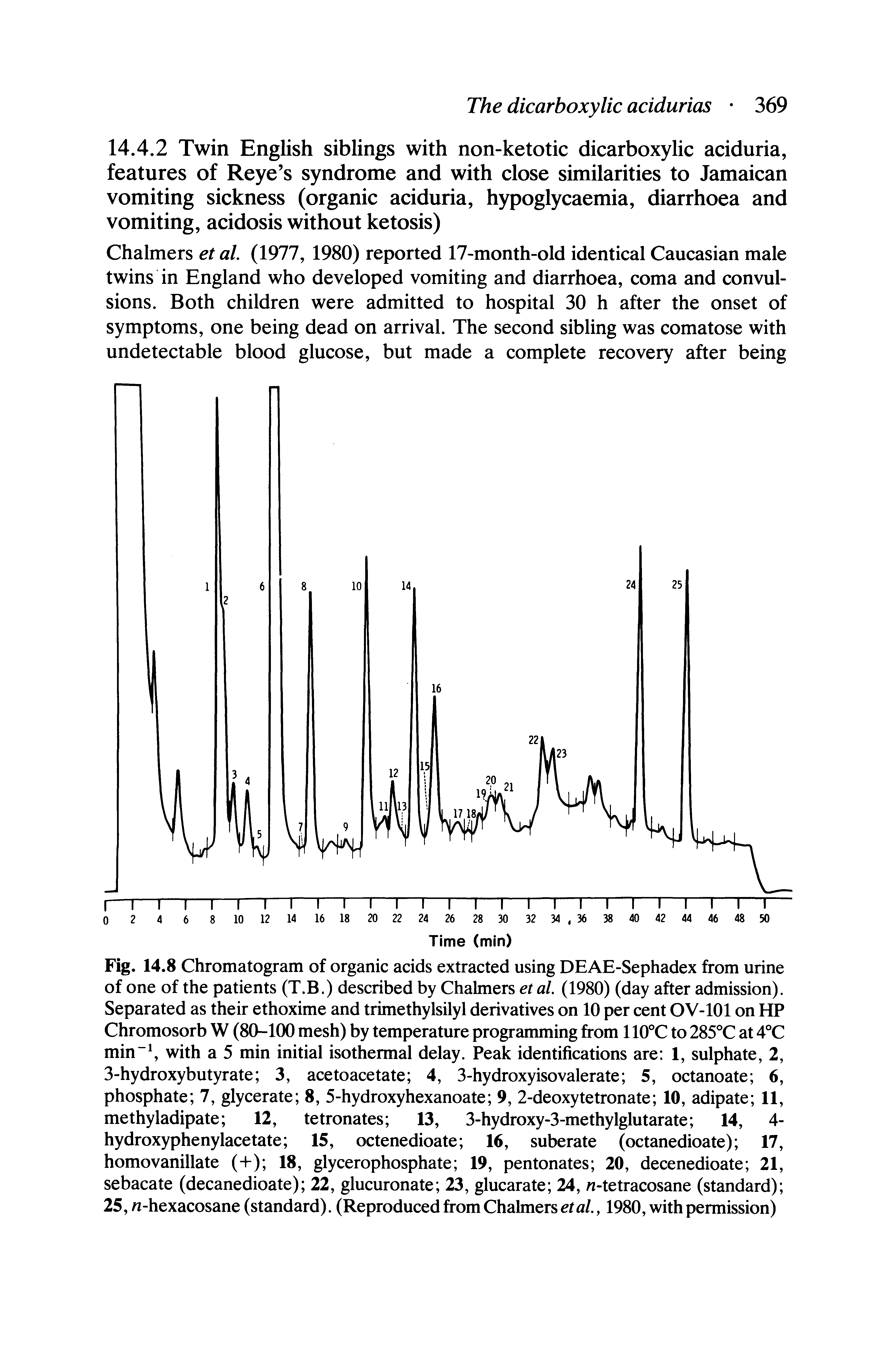 Fig. 14.8 Chromatogram of organic acids extracted using DEAE-Sephadex from urine of one of the patients (T.B.) described by Chalmers et al. (1980) (day after admission). Separated as their ethoxime and trimethylsilyl derivatives on 10 per cent OV-101 on HP Chromosorb W (80-100 mesh) by temperature programming from 110°C to 285°C at 4°C min with a 5 min initial isothermal delay. Peak identifications are 1, sulphate, 2, 3-hydroxybutyrate 3, acetoacetate 4, 3-hydroxyisovalerate 5, octanoate 6, phosphate 7, glycerate 8, 5-hydroxyhexanoate 9, 2-deoxytetronate 10, adipate 11, methyladipate 12, tetronates 13, 3-hydroxy-3-methylglutarate 14, 4-...