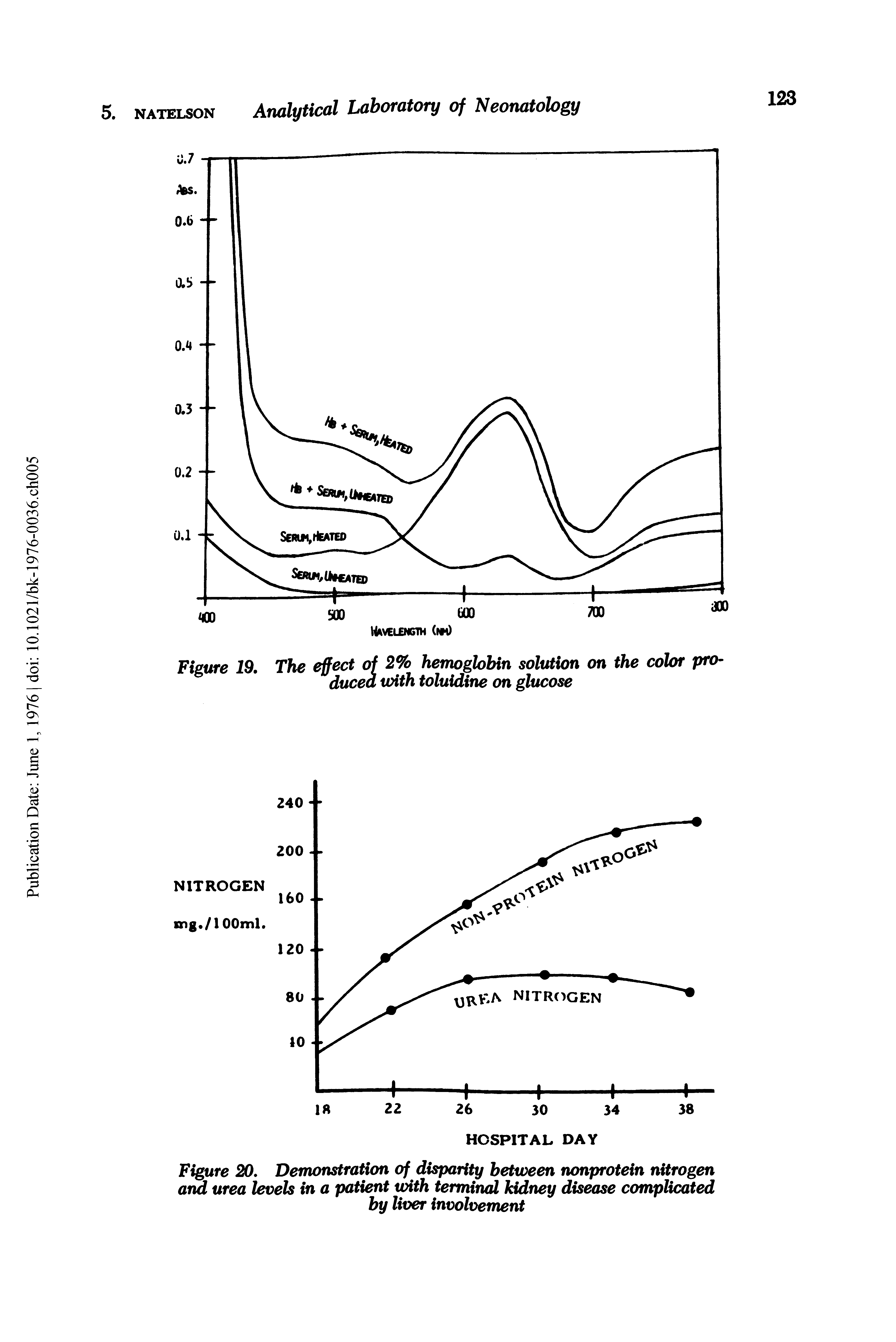 Figure 20, Demonstration of disparity between nonprotein nitrogen and urea levels in a patient with terminal kidney disease complicated by liver involvement...