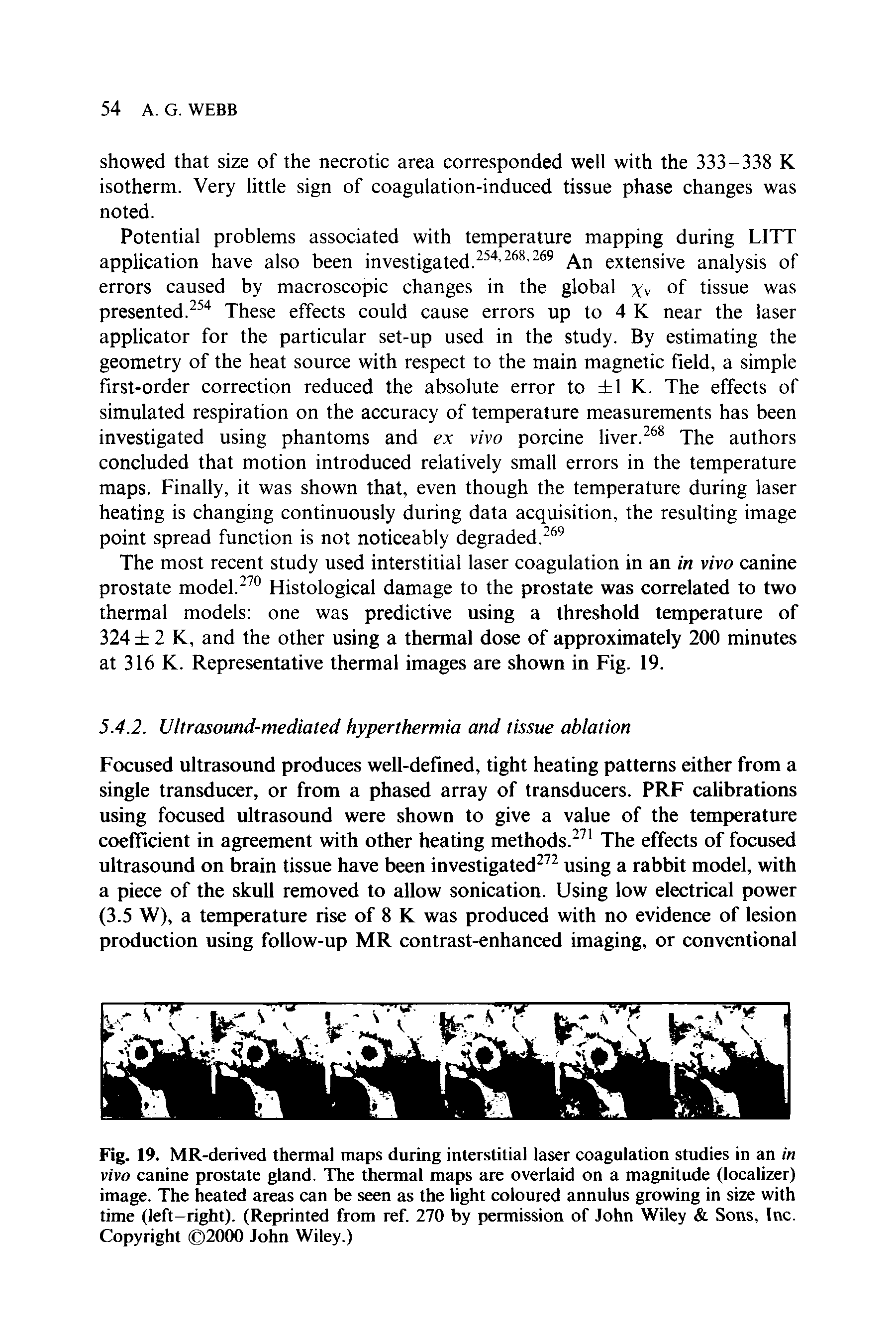 Fig. 19. MR-derived thermal maps during interstitial laser coagulation studies in an in vivo canine prostate gland. The thermal maps are overlaid on a magnitude (localizer) image. The heated areas can be seen as the light coloured annulus growing in size with time (left-right). (Reprinted from ref. 270 by permission of John Wiley Sons, Inc. Copyright 2000 John Wiley.)...