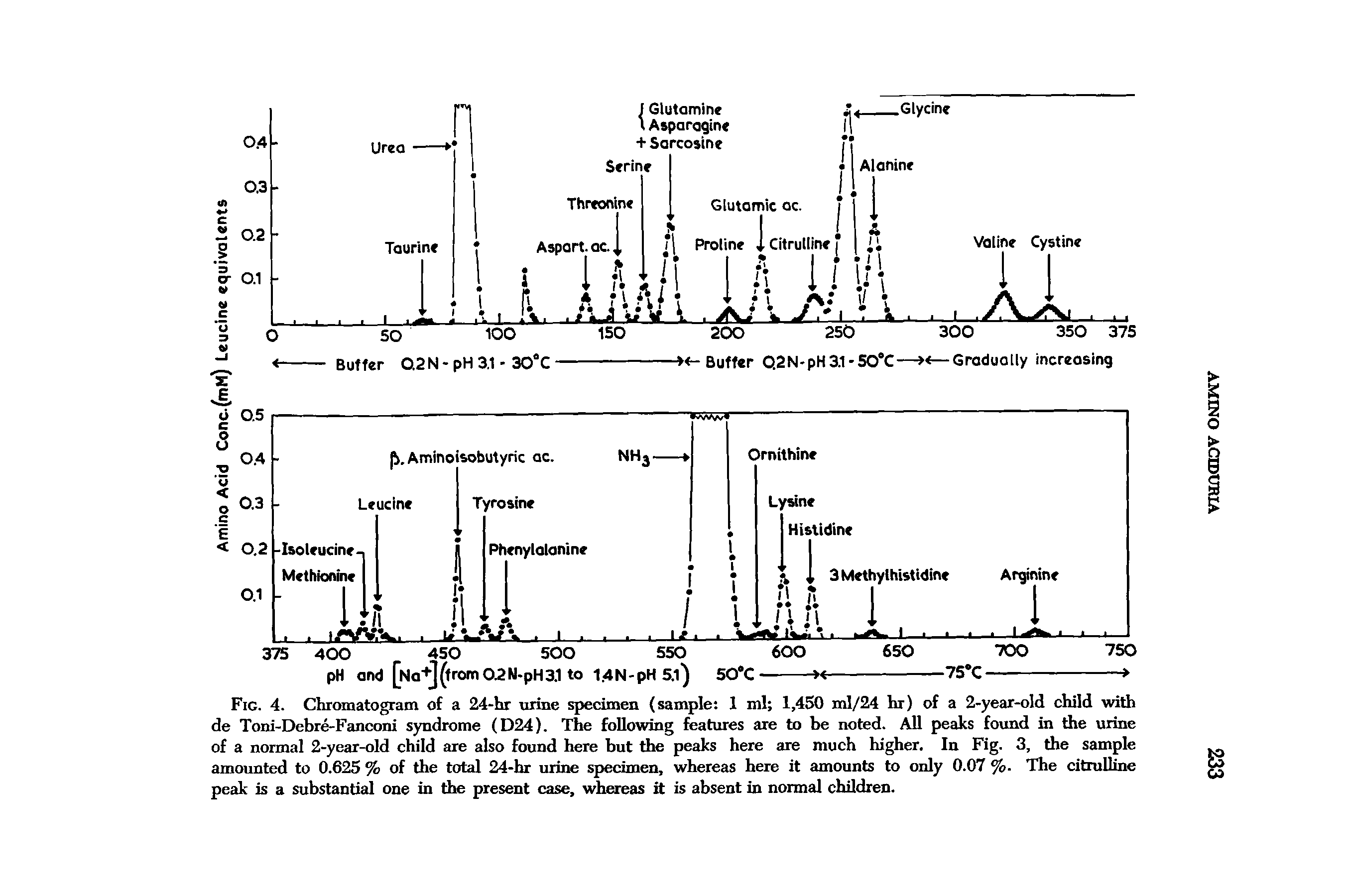 Fig. 4. Chromatogram of a 24-hr urine specimen (sample 1 ml 1,450 ml/24 hr) of a 2-year-old child with de Toni-Debre-Fanconi syndrome (D24). The following features are to be noted. All peaks found in the urine of a normal 2-year-old child are also found here but the peaks here are much higher. In Fig. 3, the sample amounted to 0.625 % of the total 24-hr urine specimen, whereas here it amounts to only 0.07 %. The citrulline peak is a substantial one in the present case, whereas it is absent in normal children.