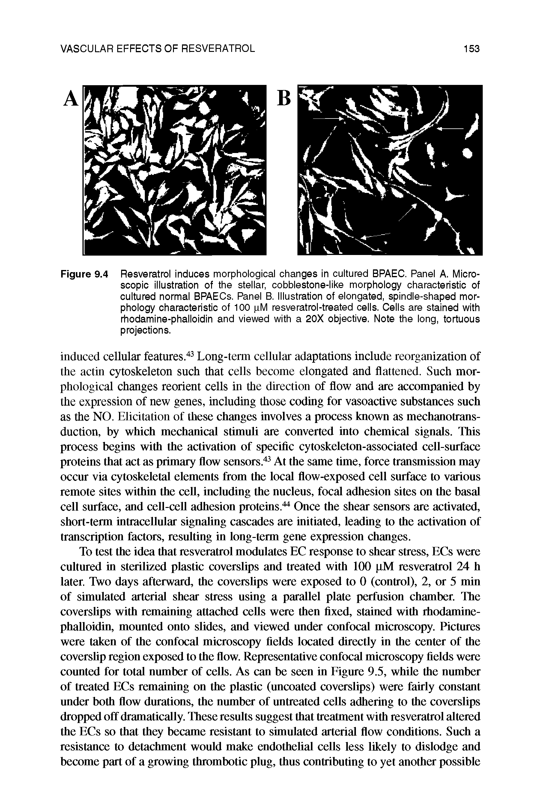 Figure 9.4 Resveratrol induces morphological changes in cultured BPAEC. Panel A. Microscopic illustration of the stellar, cobblestone-like morphology characteristic of cultured normal BPAECs. Panel B. Illustration of elongated, spindle-shaped morphology characteristic of 100 pM resveratrol-treated cells. Cells are stained with rhodamine-phalloidin and viewed with a 20X objective. Note the long, tortuous projections.