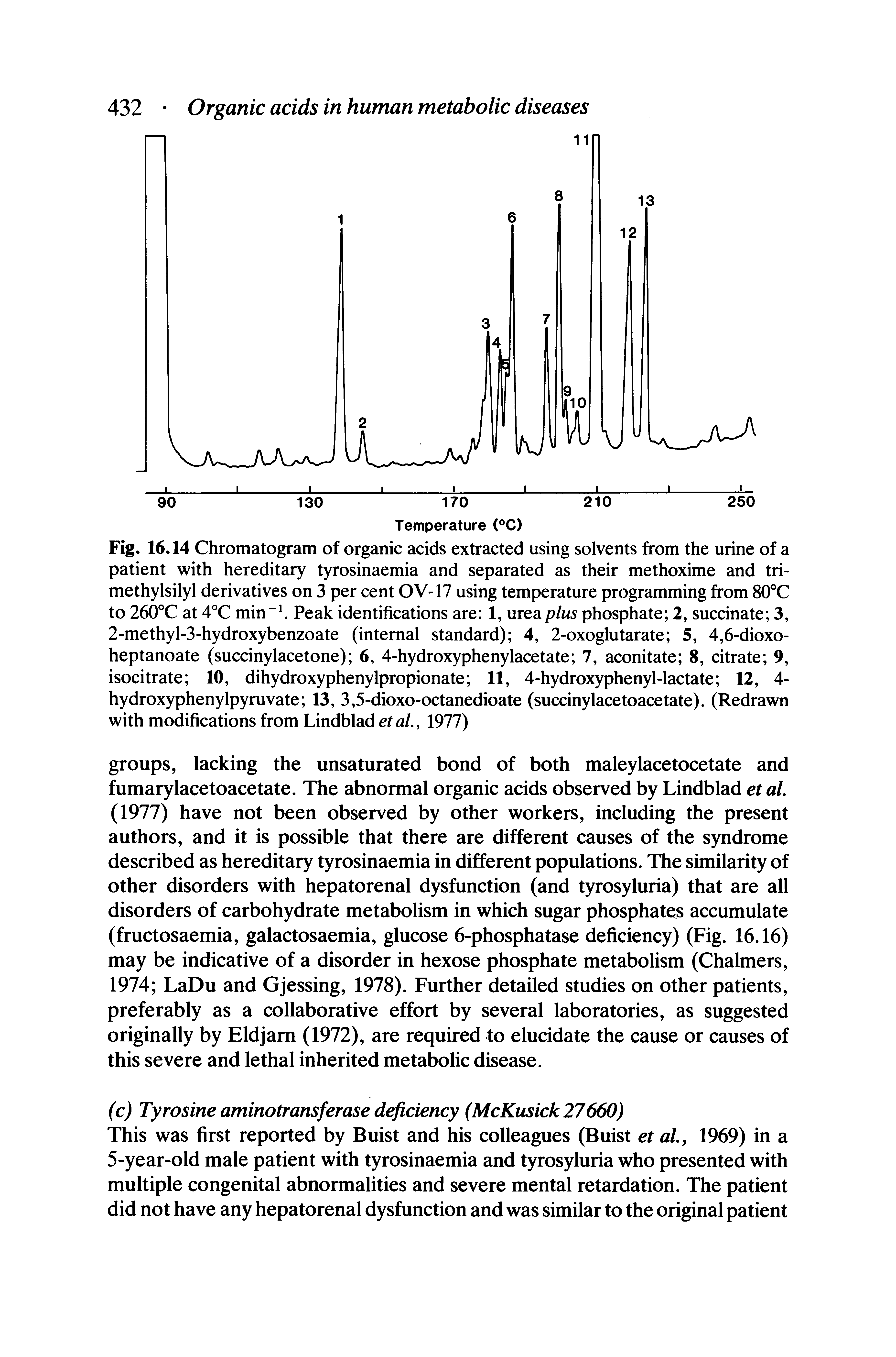 Fig. 16.14 Chromatogram of organic acids extracted using solvents from the urine of a patient with hereditary tyrosinaemia and separated as their methoxime and tri-methylsilyl derivatives on 3 per cent OV-17 using temperature programming from 80°C to 260°C at 4°C min Peak identifications are 1, urea plus phosphate 2, succinate 3, 2-methyl-3-hydroxybenzoate (internal standard) 4, 2-oxoglutarate 5, 4,6-dioxo-heptanoate (succinylacetone) 6, 4-hydroxyphenylacetate 7, aconitate 8, citrate 9, isocitrate 10, dihydroxyphenylpropionate 11, 4-hydroxyphenyl-lactate 12, 4-hydroxyphenylpyruvate 13, 3,5-dioxo-octanedioate (succinylacetoacetate). (Redrawn with modifications from Lindblad etal, 1977)...