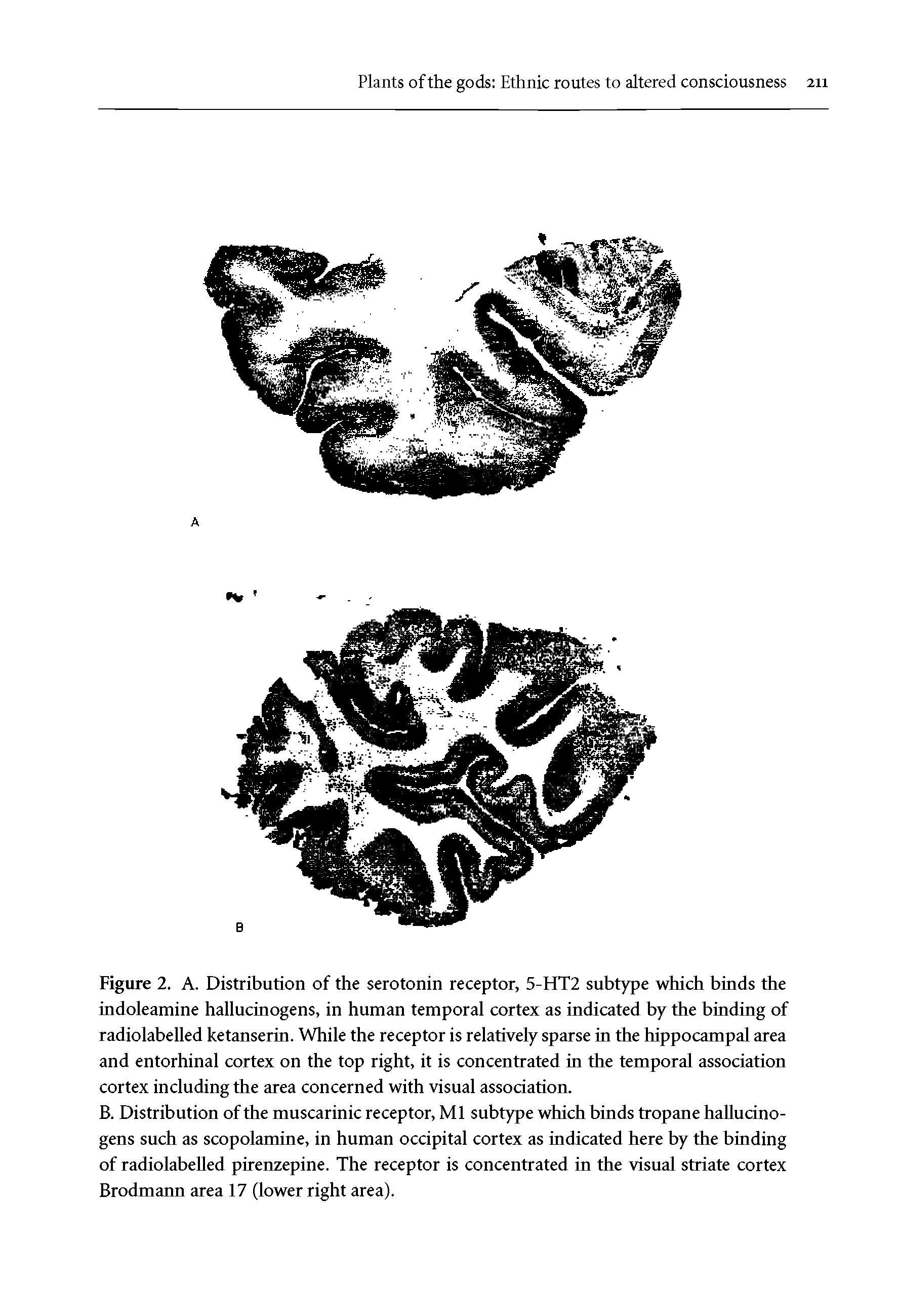 Figure 2. A. Distribution of the serotonin receptor, 5-HT2 subtype which binds the indoleamine hallucinogens, in human temporal cortex as indicated by the binding of radiolabelled ketanserin. While the receptor is relatively sparse in the hippocampal area and entorhinal cortex on the top right, it is concentrated in the temporal association cortex including the area concerned with visual association.