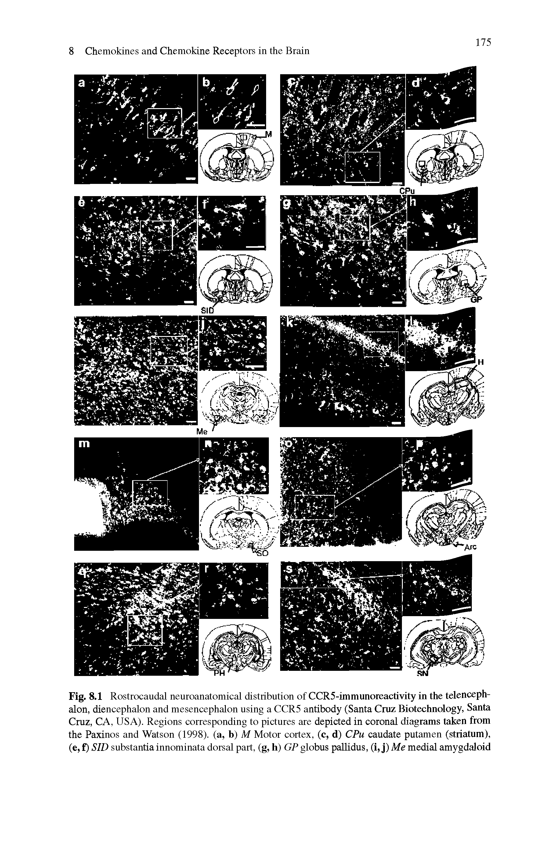 Fig. 8.1 Rostrocaudal neuroanatomical distribution of CCR5-immunoreactivity in the telencephalon, diencephalon and mesencephalon using a CCR5 antibody (Santa Cruz Biotechnology, Santa Cruz, CA, USA). Regions corresponding to pictures are depicted in coronal diagrams taken from the Paxinos and Watson (1998). (a, b) M Motor cortex, (c, d) CPu caudate putamen (striatum), (e,t)SID substantia innominata dorsal part, (g, h) GP globus pallidus, (i, j)Me medial amygdaloid...