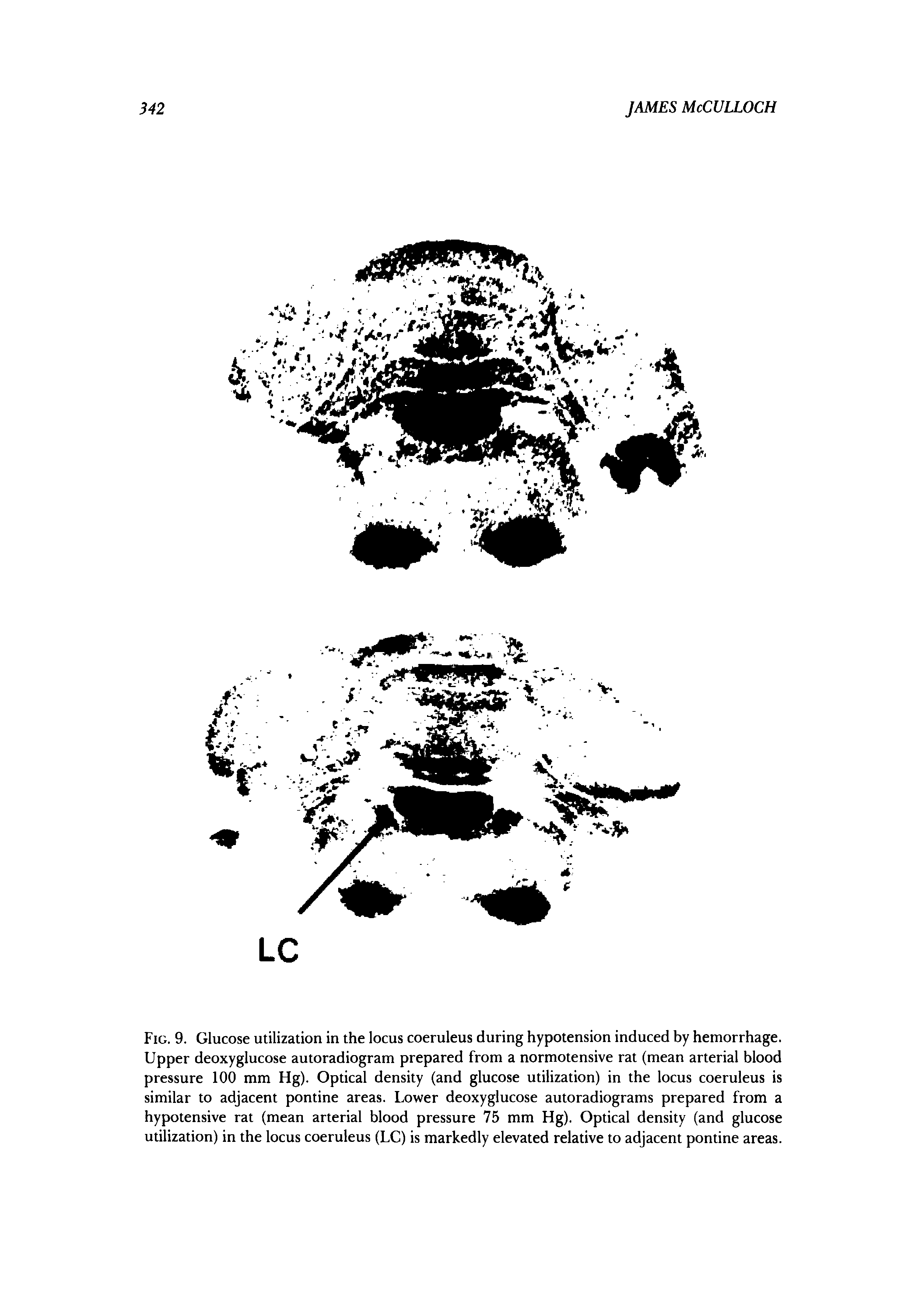Fig. 9. Glucose utilization in the locus coeruleus during hypotension induced by hemorrhage. Upper deoxyglucose autoradiogram prepared from a normotensive rat (mean arterial blood pressure 100 mm Hg). Optical density (and glucose utilization) in the locus coeruleus is similar to adjacent pontine areas. Lower deoxyglucose autoradiograms prepared from a hypotensive rat (mean arterial blood pressure 75 mm Hg). Optical density (and glucose utilization) in the locus coeruleus (LC) is markedly elevated relative to adjacent pontine areas.
