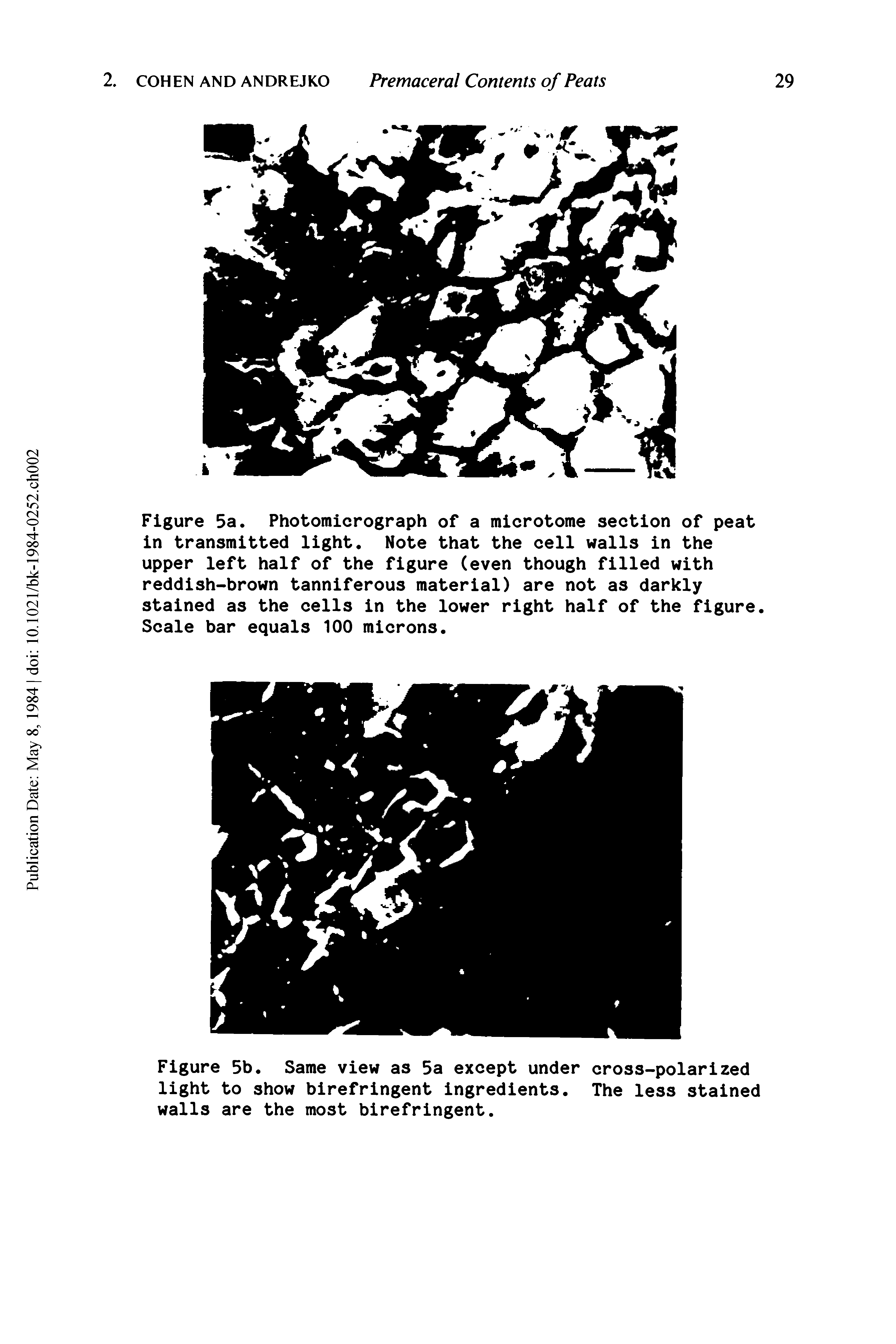 Figure 5b. Same view as 5a except under cross-polarized light to show birefringent ingredients. The less stained walls are the most birefringent.