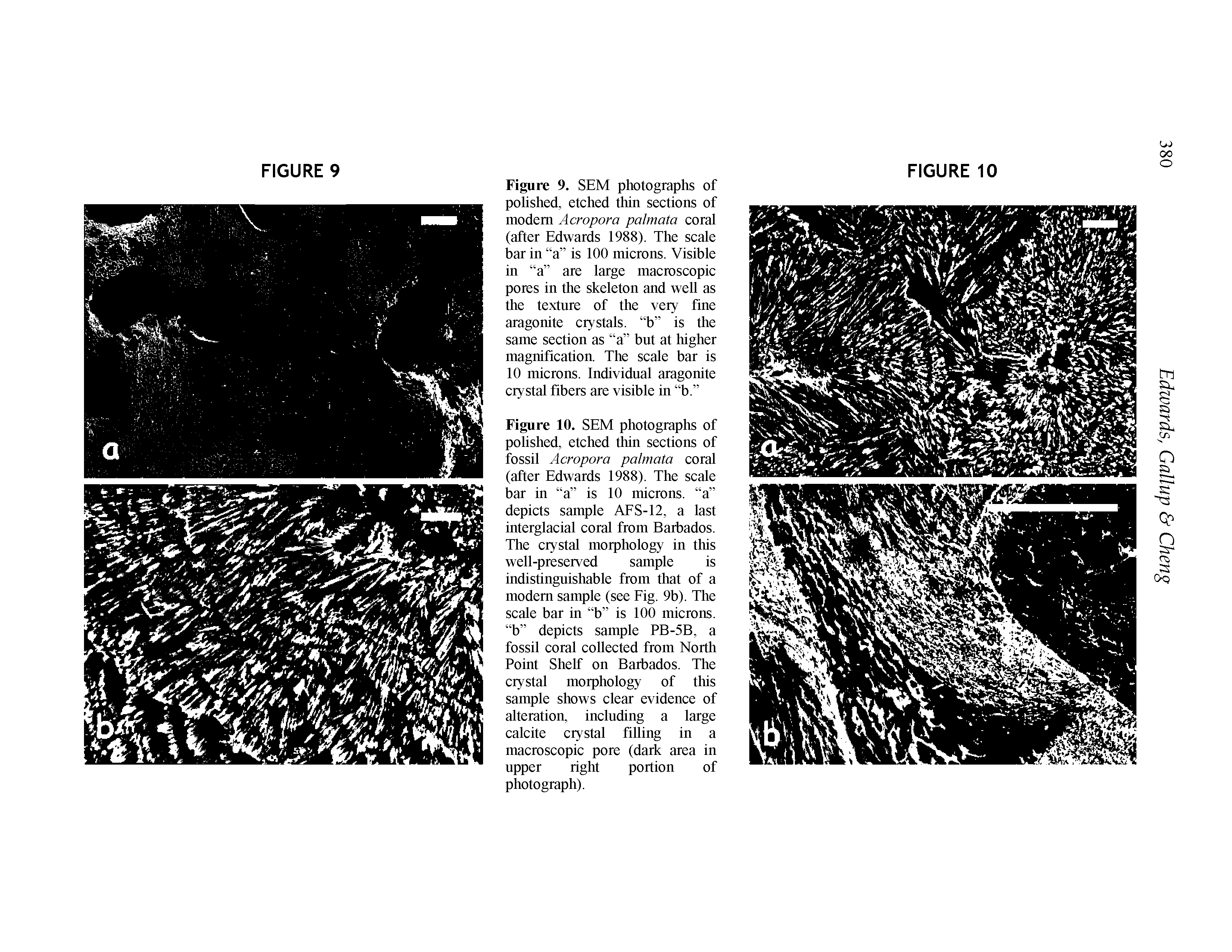 Figure 10. SEM photographs of polished, etched thin sections of fossil Acropora palmata coral (after Edwards 1988). The scale bar in a is 10 microns, a depicts sample AFS-12, a last interglacial coral from Barbados. The crystal morphology in this well-preserved sample is indistingnishable from that of a modem sample (see Fig. 9b). The scale bar in b is 100 microns, b depicts sample PB-5B, a fossil coral collected from North Point Shelf on Barbados. The crystal morphology of this sample shows clear evidence of alteration, inclnding a large calcite crystal filling in a macroscopic pore (dark area in npper right portion of photograph).