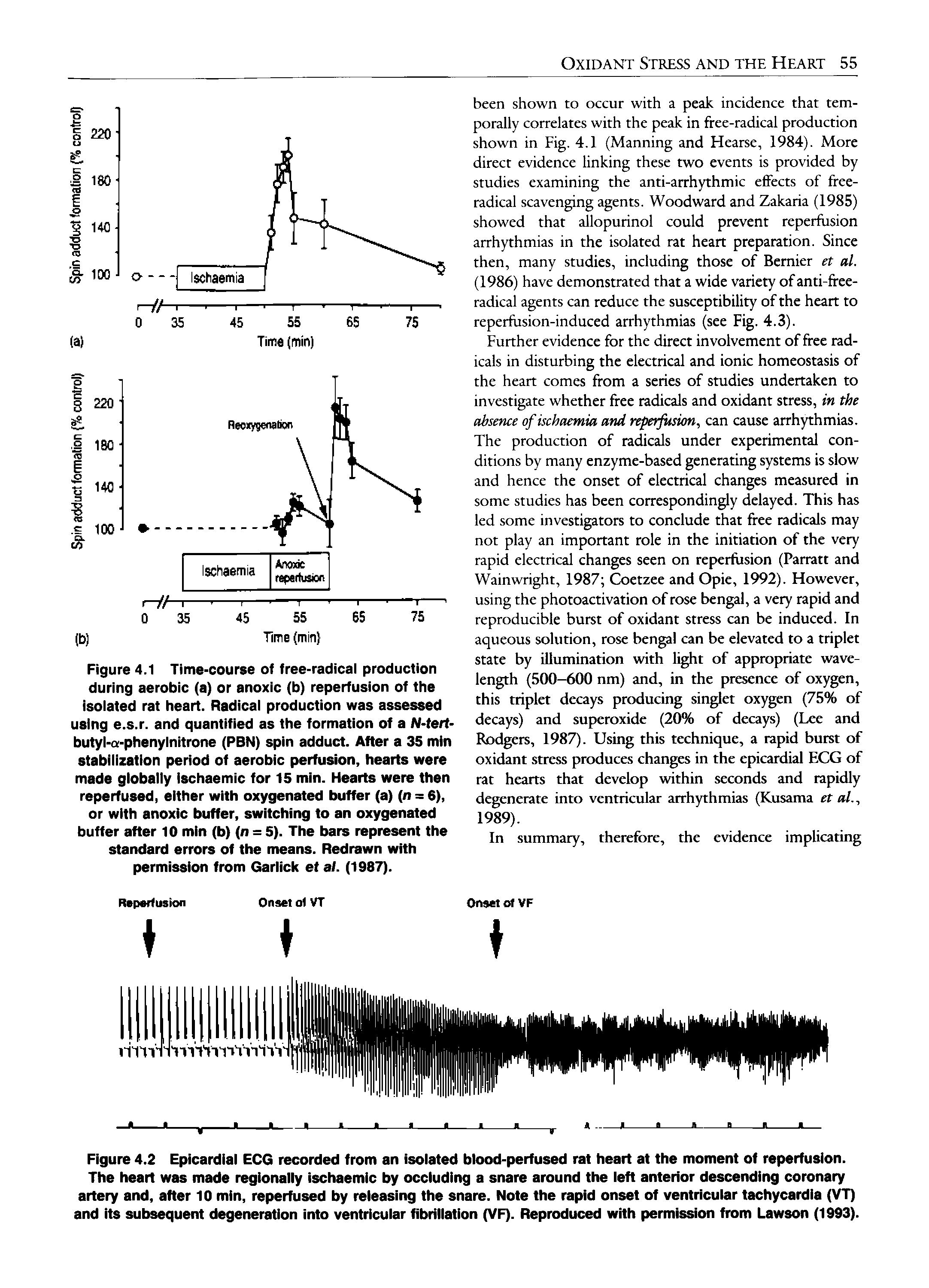 Figure 4.2 Epicardial ECG recorded from an isolated blood-perfused rat heart at the moment of reperfusion. The heart was made regionally ischaemic by occluding a snare around the left anterior descending coronary artery and, after 10 min, reperfused by releasing the snare. Note the rapid onset of ventricular tachycardia (VT) and its subsequent degeneration into ventricular fibrillation (VF). Reproduced with permission from Lawson (1993).