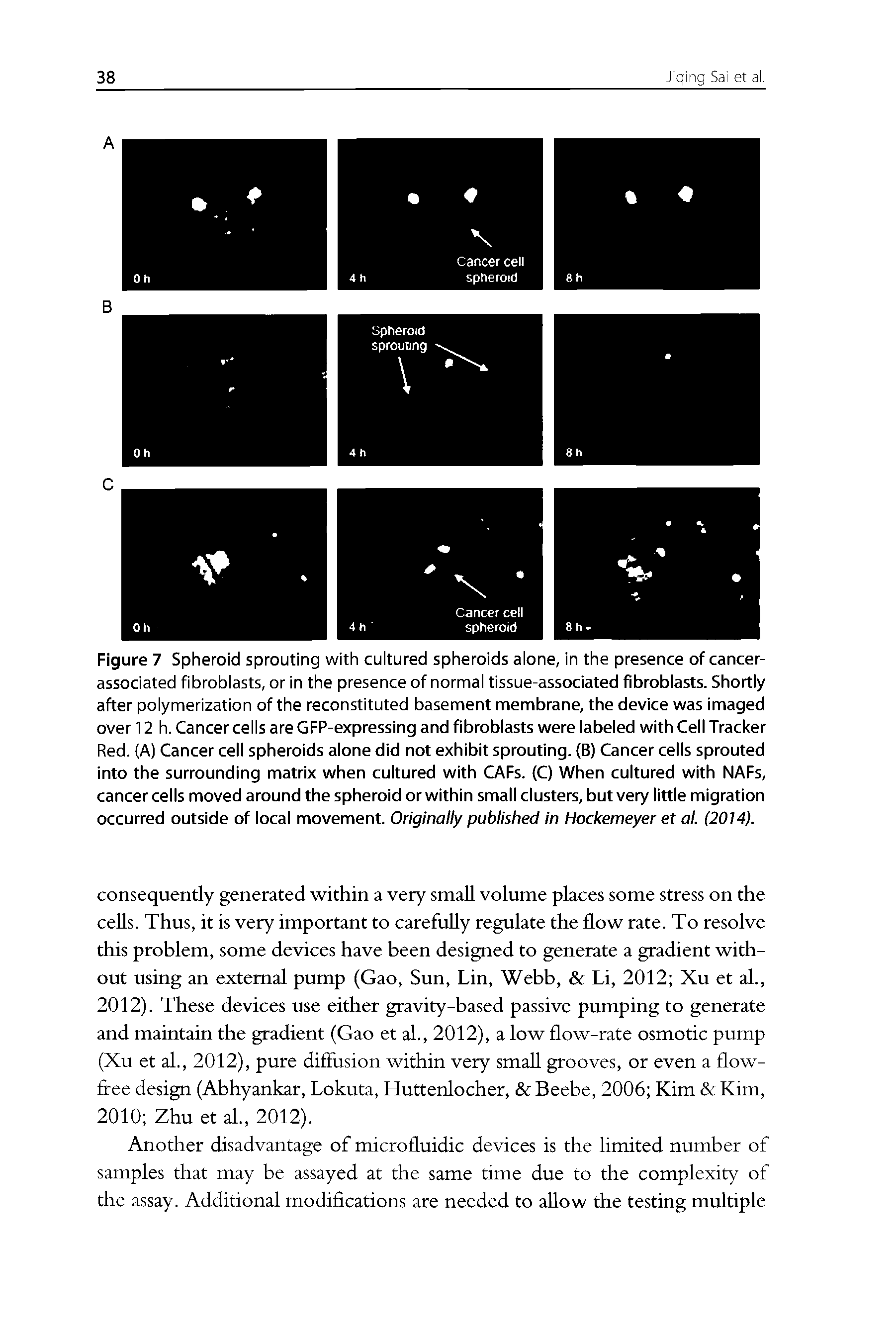 Figure 7 Spheroid sprouting with cultured spheroids alone, in the presence of cancer-associated fibroblasts, or in the presence of normal tissue-associated fibrobiasts. Shortiy after polymerization of the reconstituted basement membrane, the device was imaged over 12 h. Cancer cells are GFP-expressing and fibroblasts were labeled with Cell Tracker Red. (A) Cancer cell spheroids alone did not exhibit sprouting. (B) Cancer cells sprouted into the surrounding matrix when cultured with CAFs. (C) When cultured with NAFs, cancer cells moved around the spheroid or within small clusters, but very little migration occurred outside of local movement. Originally published in Hockemeyer et al. (2014).