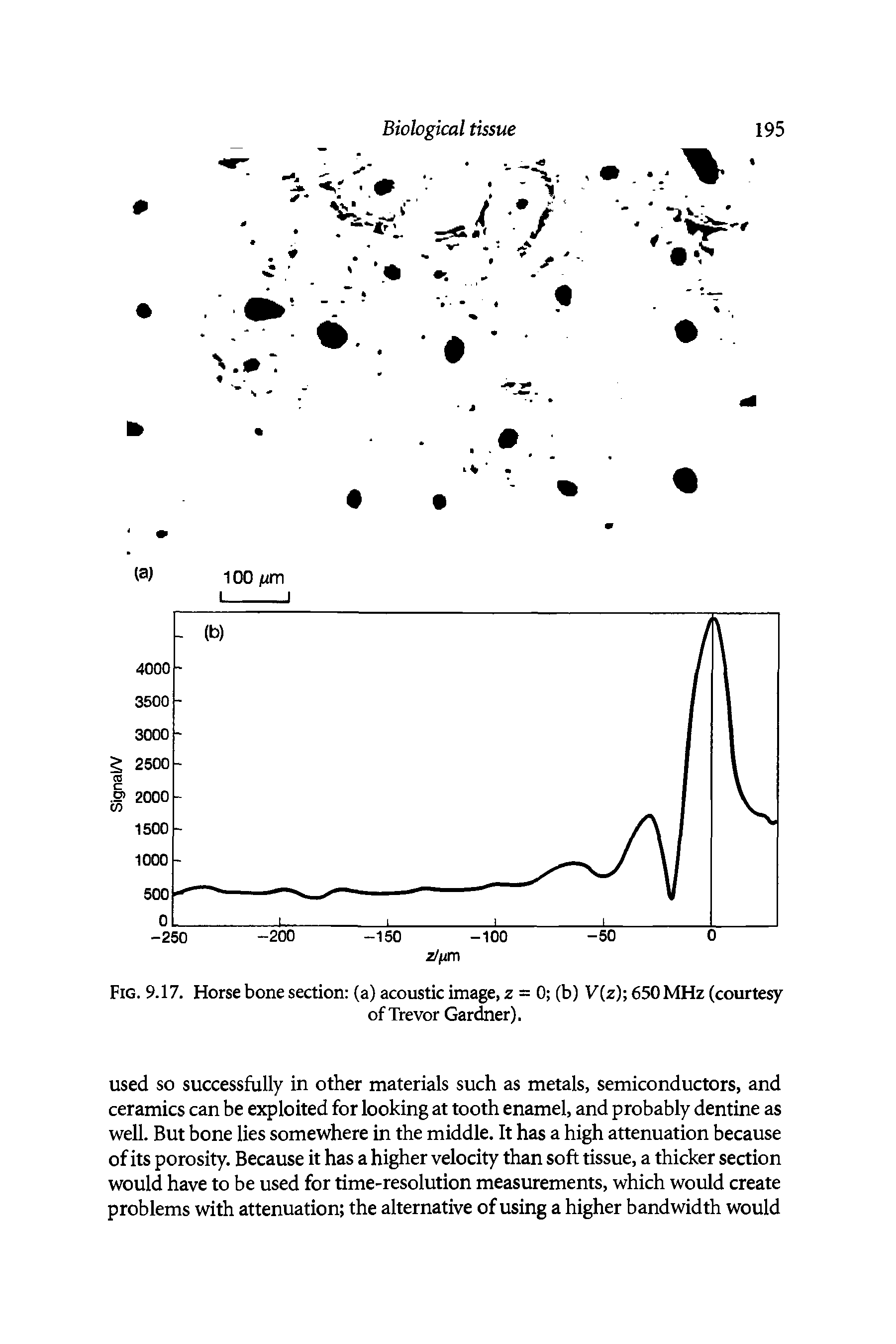 Fig. 9.17. Horse bone section (a) acoustic image, z = 0 (b) V(z) 650 MHz (courtesy...
