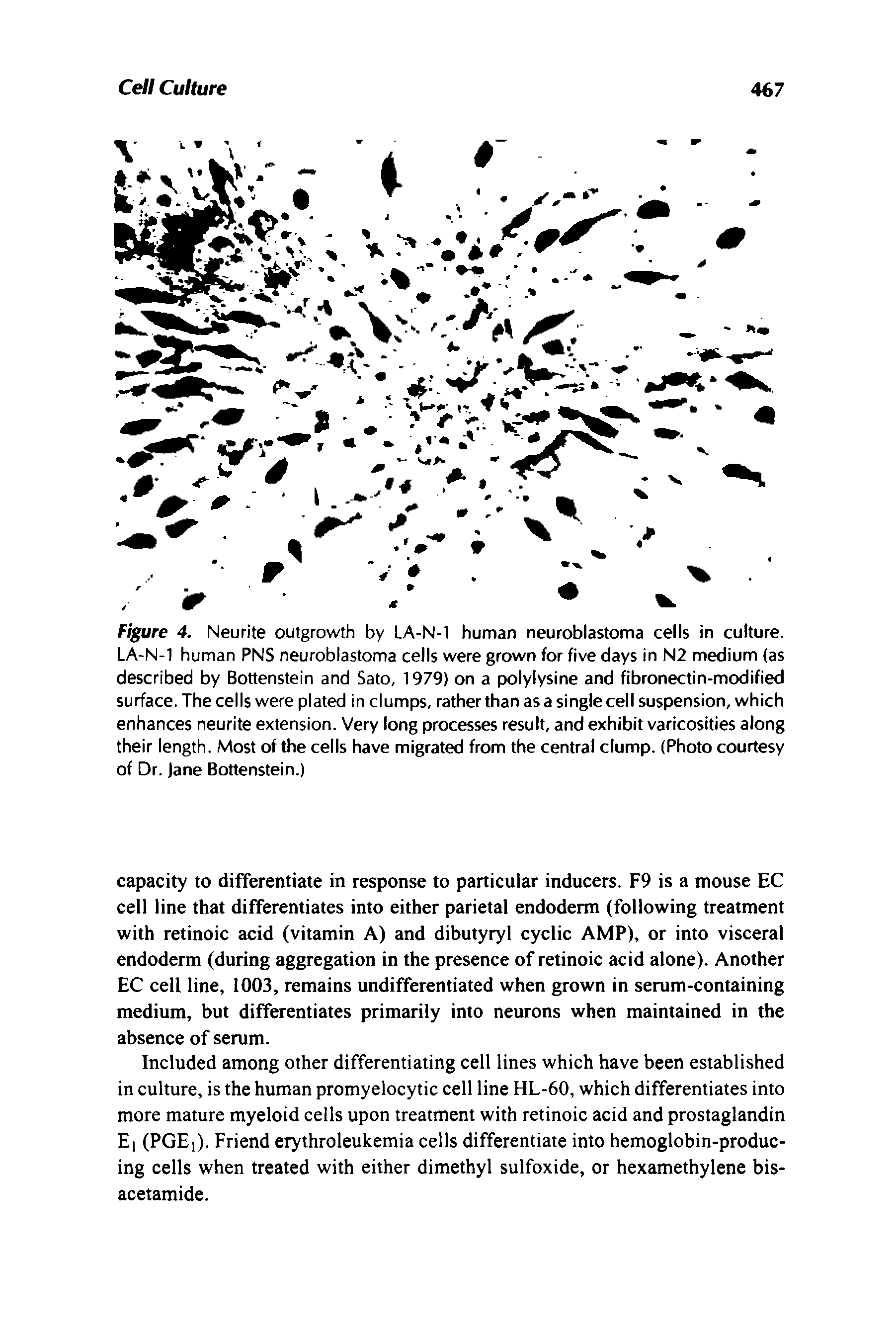 Figure 4. Neurite outgrowth by LA-N-1 human neuroblastoma cells in culture. LA-N-1 human PNS neuroblastoma cells were grown for five days in N2 medium (as described by Bottenstein and Sato, 1979) on a polylysine and fibronectin-modified surface. The cells were plated in clumps, rather than as a single cell suspension, which enhances neurite extension. Very long processes result, and exhibit varicosities along their length. Most of the cells have migrated from the central clump. (Photo courtesy of Dr. jane Bottenstein.)...