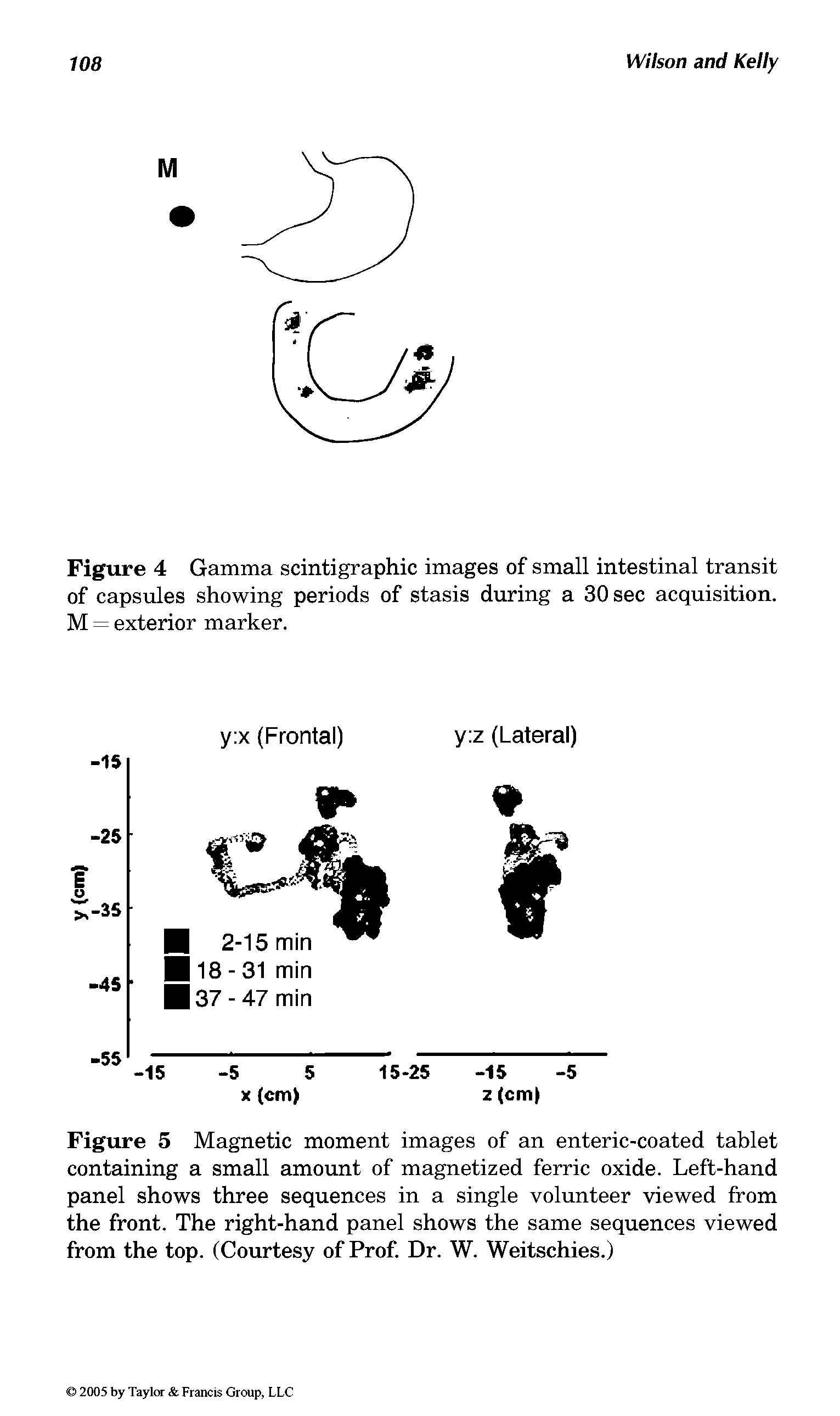 Figure 5 Magnetic moment images of an enteric-coated tablet containing a small amount of magnetized ferric oxide. Left-hand panel shows three sequences in a single volunteer viewed from the front. The right-hand panel shows the same sequences viewed from the top. (Courtesy of Prof. Dr. W. Weitschies.)...