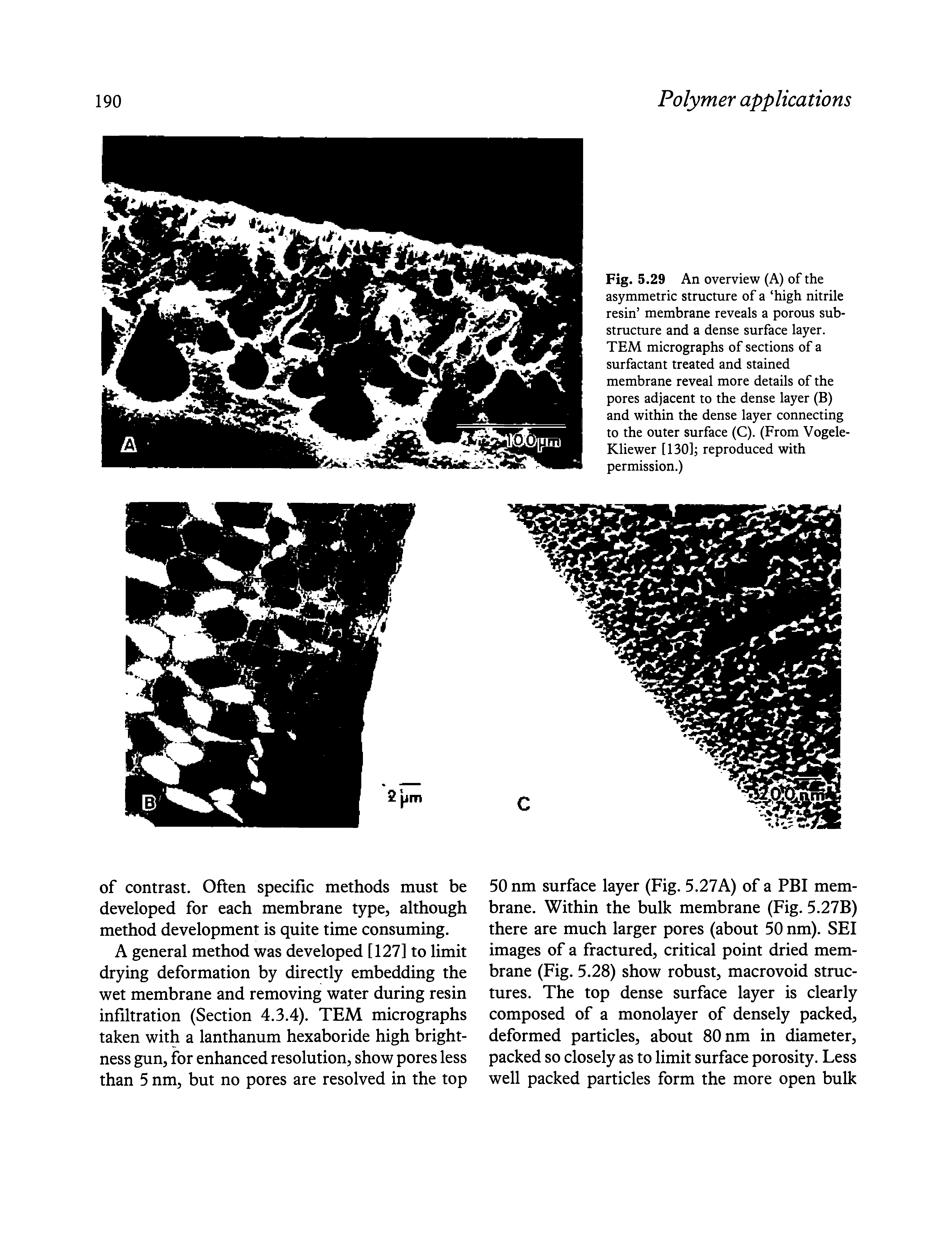 Fig. 5.29 An overview (A) of the asymmetric structure of a high nitrile resin membrane reveals a porous substructure and a dense surface layer. TEM micrographs of sections of a surfactant treated and stained membrane reveal more details of the pores adjacent to the dense layer (B) and within the dense layer connecting to the outer surface (C). (From Vogele-Kliewer [130] reproduced with permission.)...