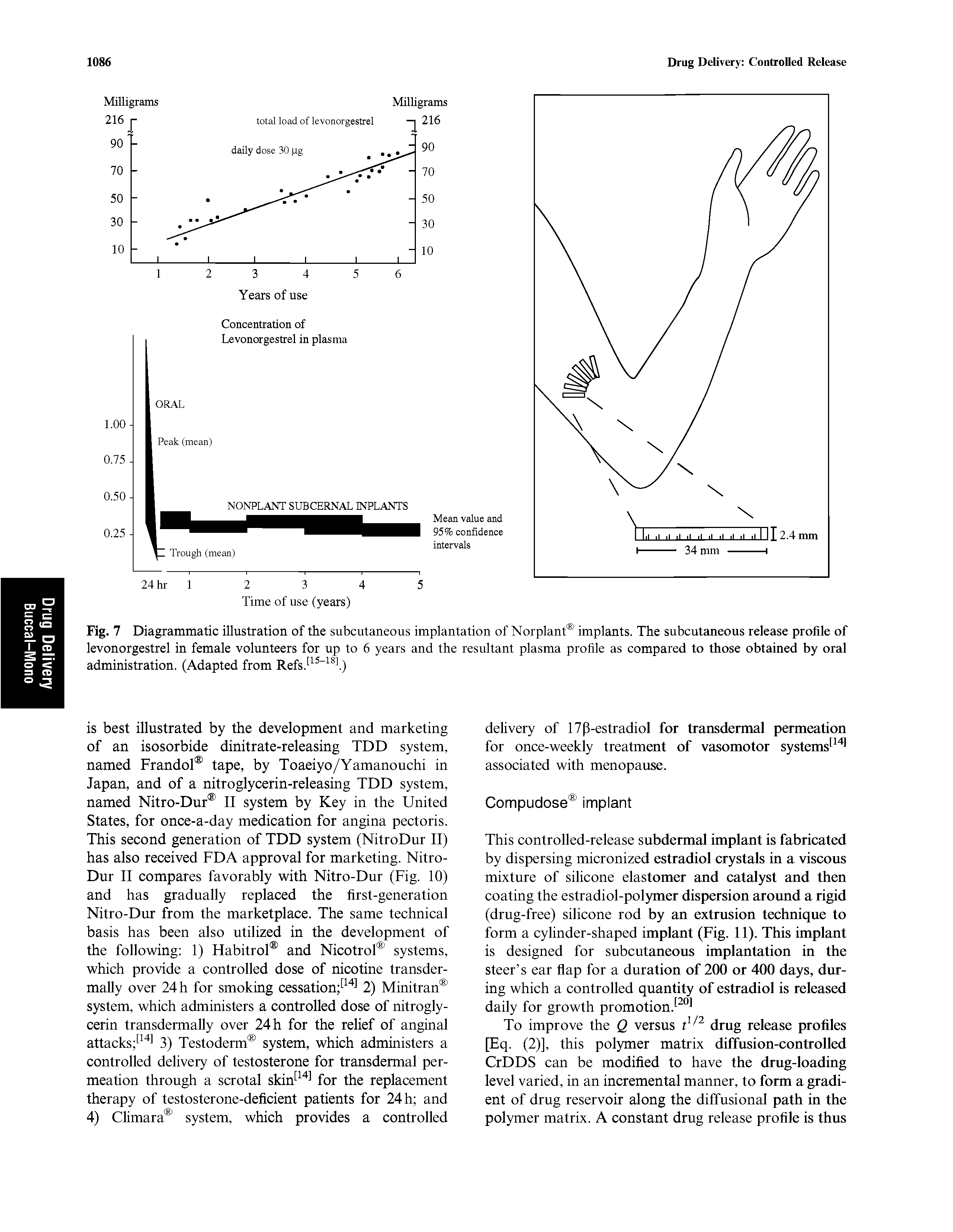 Fig. 7 Diagrammatic illustration of the subcutaneous implantation of Norplant implants. The subcutaneous release profile of levonorgestrel in female volunteers for up to 6 years and the resultant plasma profile as compared to those obtained by oral administration. (Adapted from Refs. l)...