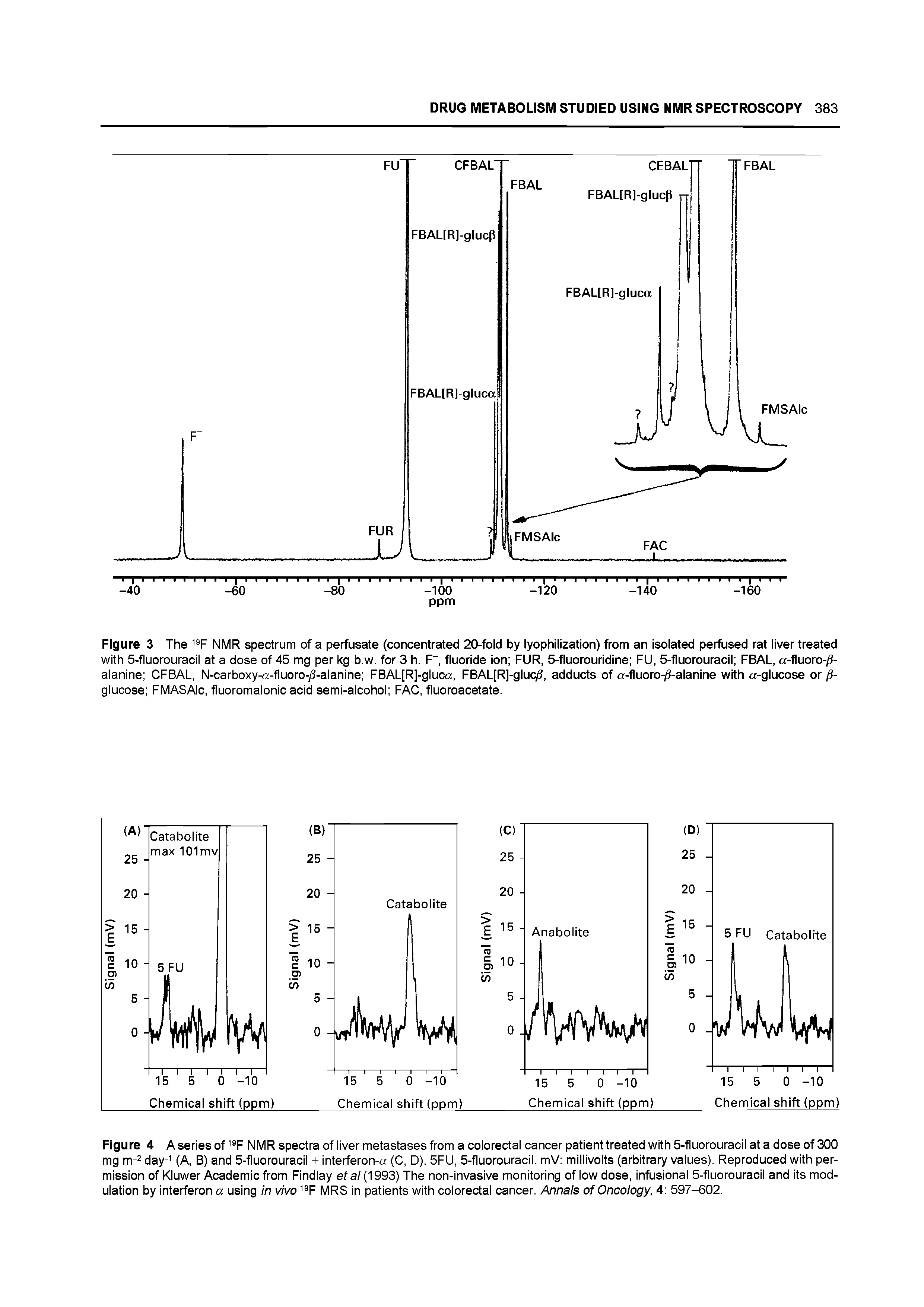 Figure 3 The NMR spectrum of a perfusate (concentrated 20-fold by lyophilization) from an isolated perfused rat liver treated with 5-fluorouracil at a dose of 45 mg per kg b.w. for 3 h. F , fluoride ion FUR, 5-fluorouridine FU, 5-fluorouracil FBAL, a-fluoro- -alanine CFBAL, N-carboxy-a-fluoro-/3-alanine FBAL[R]-gluca, FBAL[R]-glucvS, adducts of a-fluoro- -alanine with a-glucose or glucose FMASAIc, fluoromalonic acid semi-aicohci FAC, fiuoroacetate.