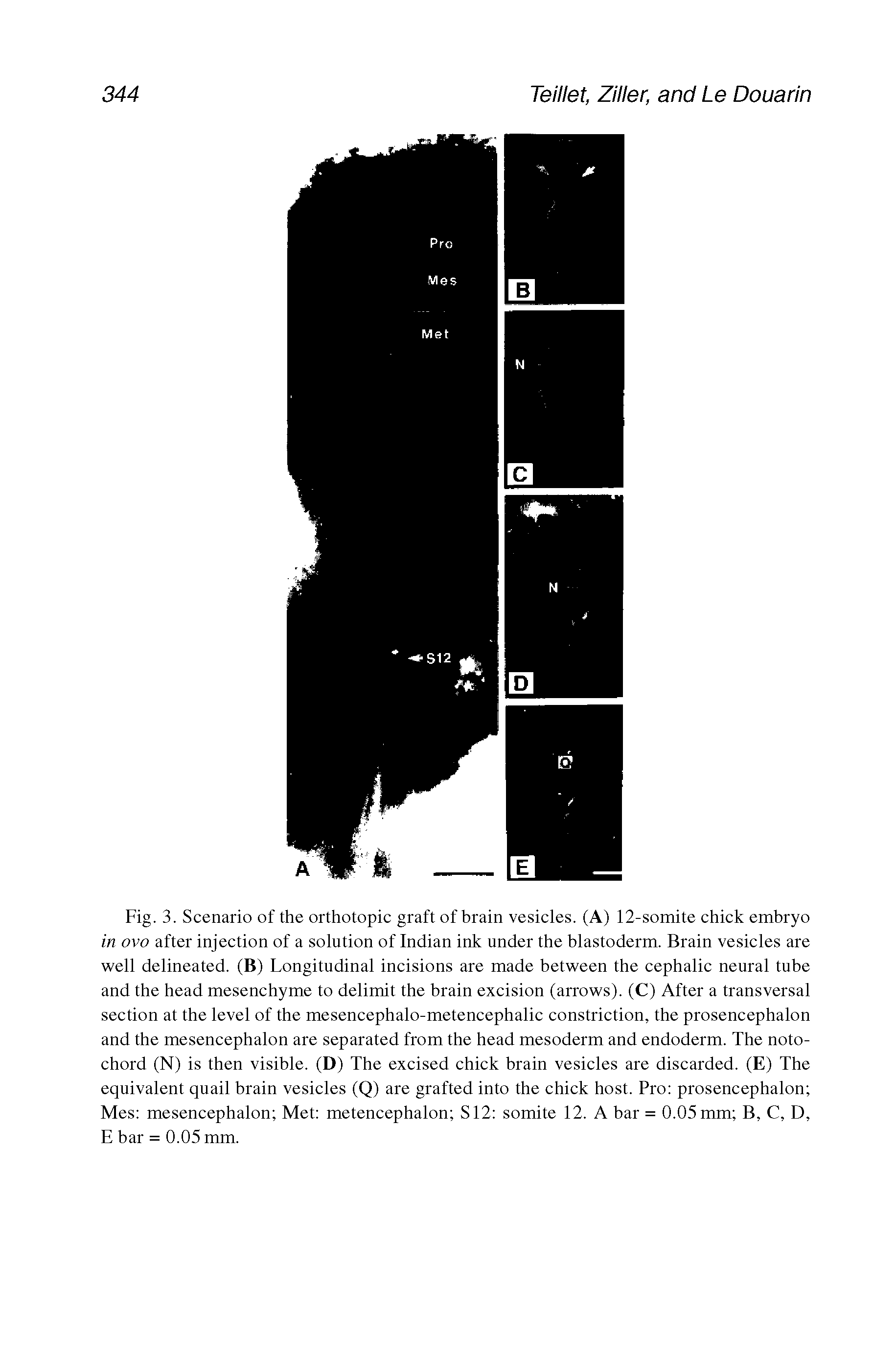 Fig. 3. Scenario of the orthotopic graft of brain vesicles. (A) 12-somite chick embryo in ovo after injection of a solution of Indian ink under the blastoderm. Brain vesicles are well delineated. (B) Longitudinal incisions are made between the cephalic neural tube and the head mesenchyme to delimit the brain excision (arrows). (C) After a transversal section at the level of the mesencephalo-metencephalic constriction, the prosencephalon and the mesencephalon are separated from the head mesoderm and endoderm. The notochord (N) is then visible. (D) The excised chick brain vesicles are discarded. (E) The equivalent quail brain vesicles (Q) are grafted into the chick host. Pro prosencephalon Mes mesencephalon Met metencephalon S12 somite 12. A bar = 0.05 mm B, C, D, E bar = 0.05 mm.