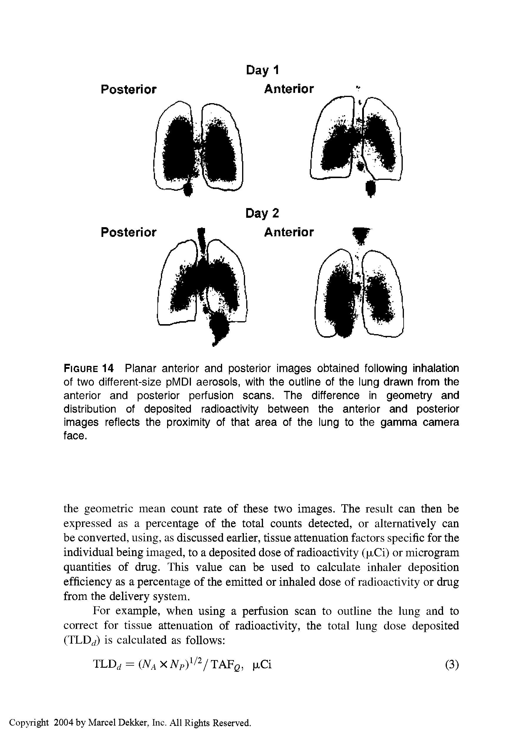 Figure 14 Planar anterior and posterior images obtained following inhalation of two different-size pMDI aerosols, with the outline of the lung drawn from the anterior and posterior perfusion scans. The difference in geometry and distribution of deposited radioactivity between the anterior and posterior images reflects the proximity of that area of the lung to the gamma camera face.