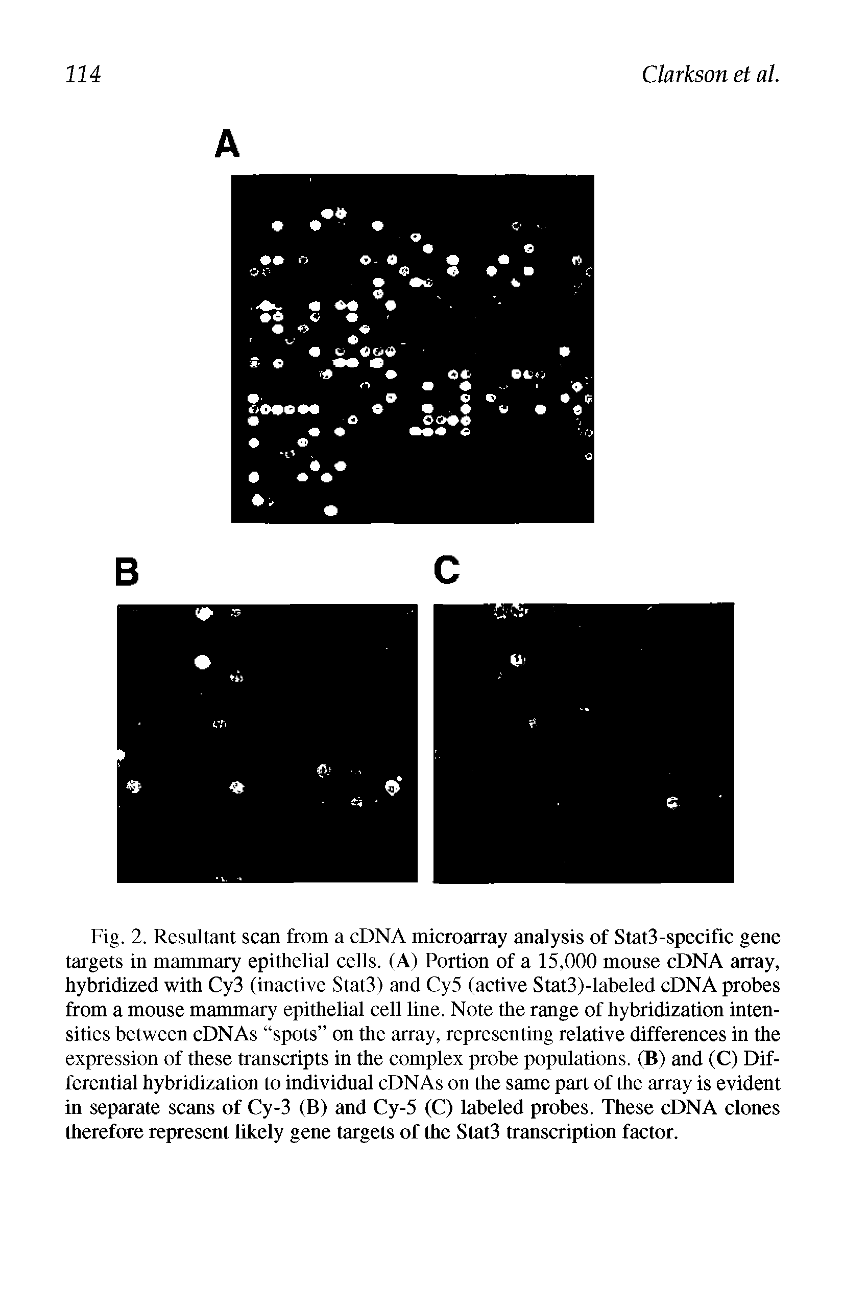 Fig. 2. Resultant scan from a cDNA microarray analysis of Stat3-specific gene targets in mammary epithelial cells. (A) Portion of a 15,000 mouse cDNA array, hybridized with Cy3 (inactive Stat3) and Cy5 (active Stat3)-labeled cDNA probes from a mouse mammary epithelial cell line. Note the range of hybridization intensities between cDNAs spots on the array, representing relative differences in the expression of these transcripts in the complex probe populations. (B) and (C) Differential hybridization to individual cDNAs on the same part of the array is evident in separate scans of Cy-3 (B) and Cy-5 (C) labeled probes. These cDNA clones therefore represent likely gene targets of the Stat3 transcription factor.