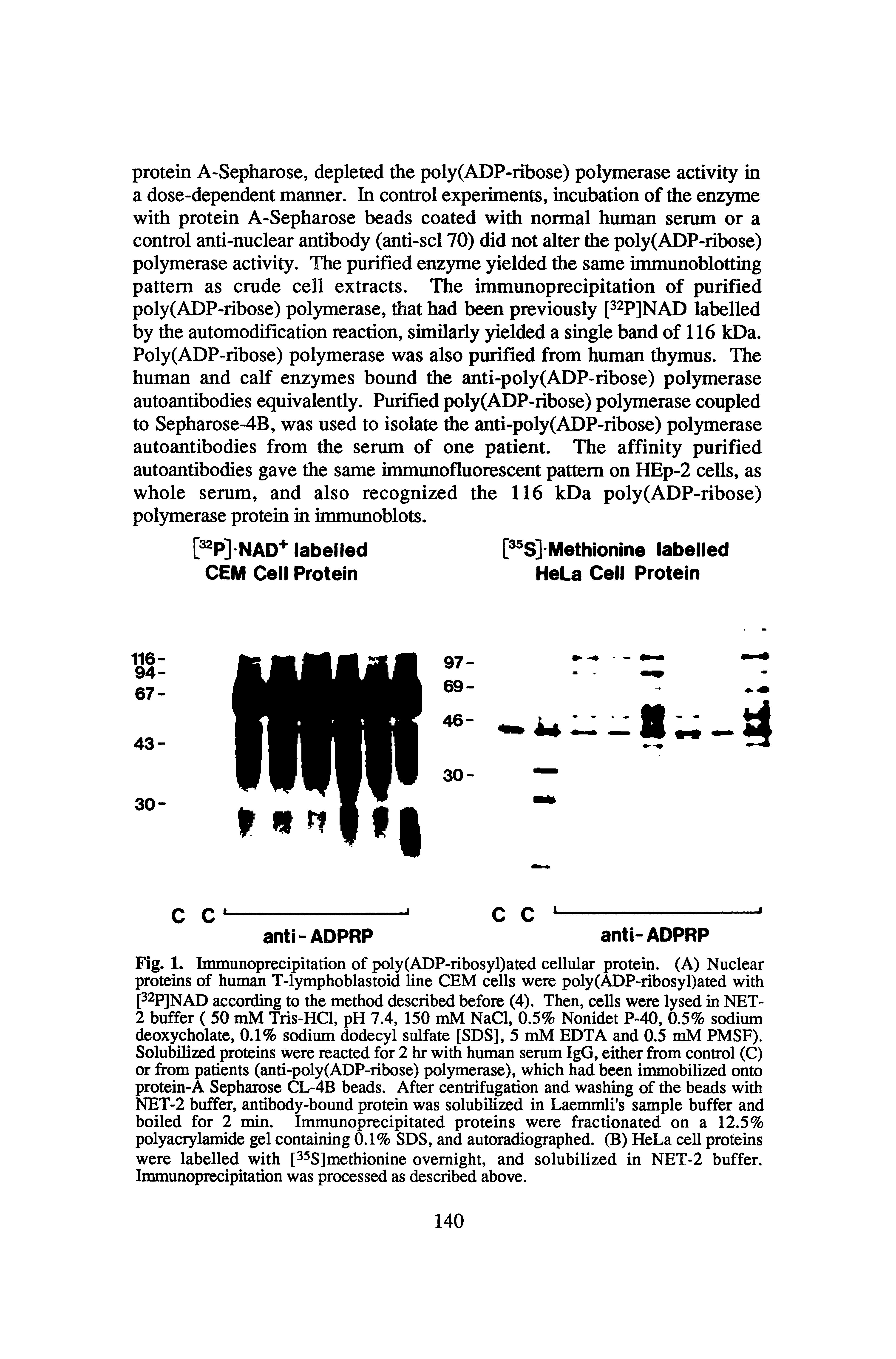 Fig. 1. Immunoprecipitation of poly(ADP-ribosyl)ated cellular protein. (A) Nuclear proteins of human T-lymphoblastoid line CEM cells were poly(ADP-ribosyl)ated with [32p]NAD according to the method described before (4). Then, cells were lysed in NET-2 buffer ( 50 mM Tris-HCl, pH 7.4, 150 mM NaCl, 0.5% Nonidet P-40, 0.5% sodium deoxycholate, 0.1% sodium dodecyl sulfate [SDS], 5 mM EDTA and 0.5 mM PMSF). Solubilized proteins were reacted for 2 hr with human serum IgG, either from control (C) or from patients (anti-poly(ADP-ribose) polymerase), which had been immobilized onto protein-A Sepharose CL-4B beads. After centrifugation and washing of the beads with NET-2 buffer, antibody-bound protein was solubilized in Laemmli s sample buffer and boiled for 2 min. Immunoprecipitated proteins were fractionated on a 12.5% polyacrylamide gel containing 0.1% SDS, and autoradiographed. (B) HeLa cell proteins were labelled with [ sjmetjiionine overnight, and solubilized in NET-2 buffer. Immunoprecipitation was processed as described above.