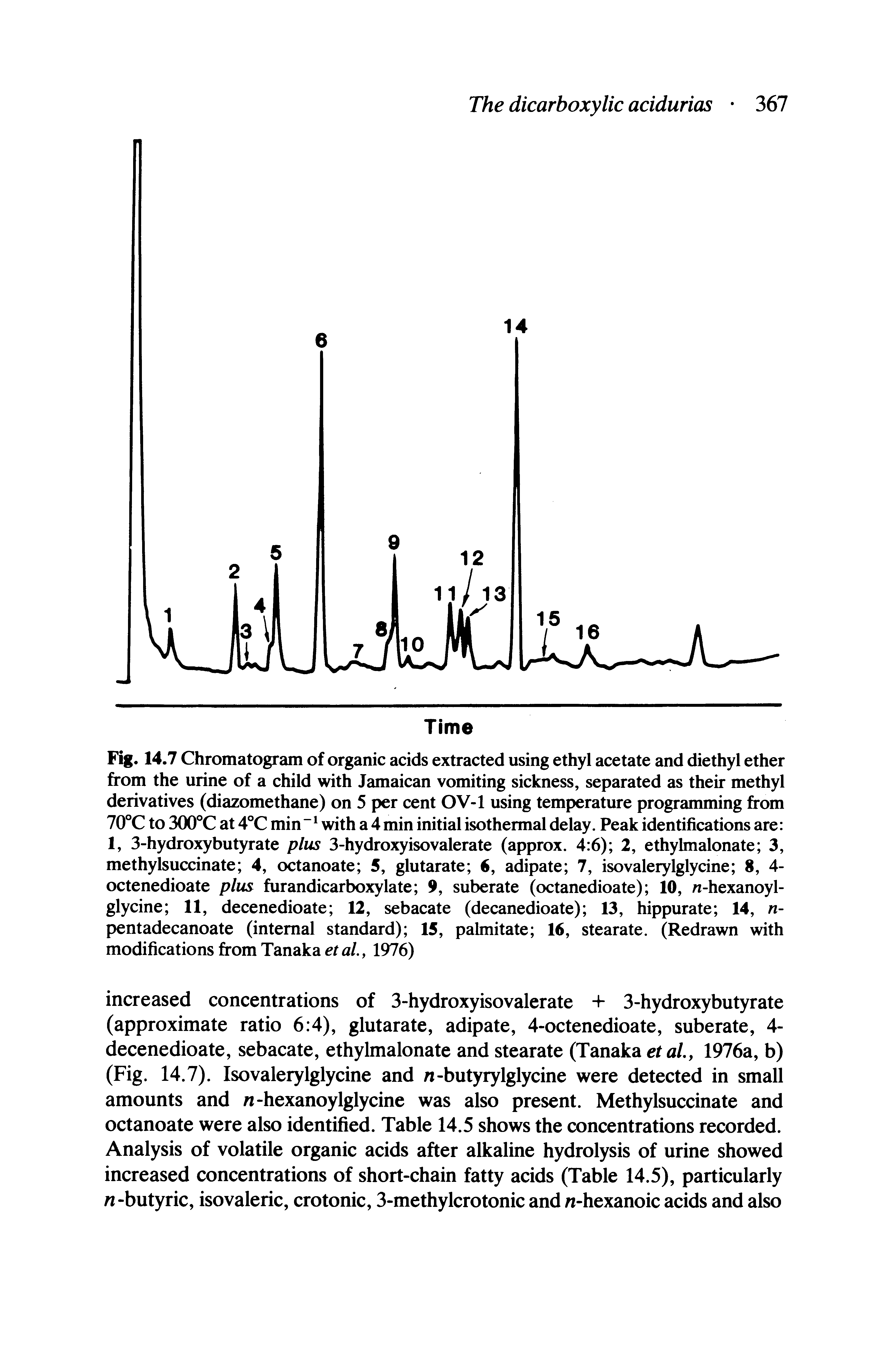 Fig. 14.7 Chromatogram of organic acids extracted using ethyl acetate and diethyl ether from the urine of a child with Jamaican vomiting sickness, separated as their methyl derivatives (diazomethane) on 5 per cent OV-1 using temperature programming from 70°C to 300°C at 4°C min with a 4 min initial isothermal delay. Peak identifications are 1, 3-hydroxybutyrate plus 3-hydroxyisovalerate (approx. 4 6) 2, ethylmalonate 3, methylsuccinate 4, octanoate 5, glutarate 6, adipate 7, isovalerylglycine 8, 4-octenedioate plus furandicarboxylate 9, suberate (octanedioate) 10, /i-hexanoyl-glycine 11, decenedioate 12, sebacate (decanedioate) 13, hippurate 14, n-pentadecanoate (internal standard) 15, palmitate 16, stearate. (Redrawn with modifications from Tanaka et al, 1976)...