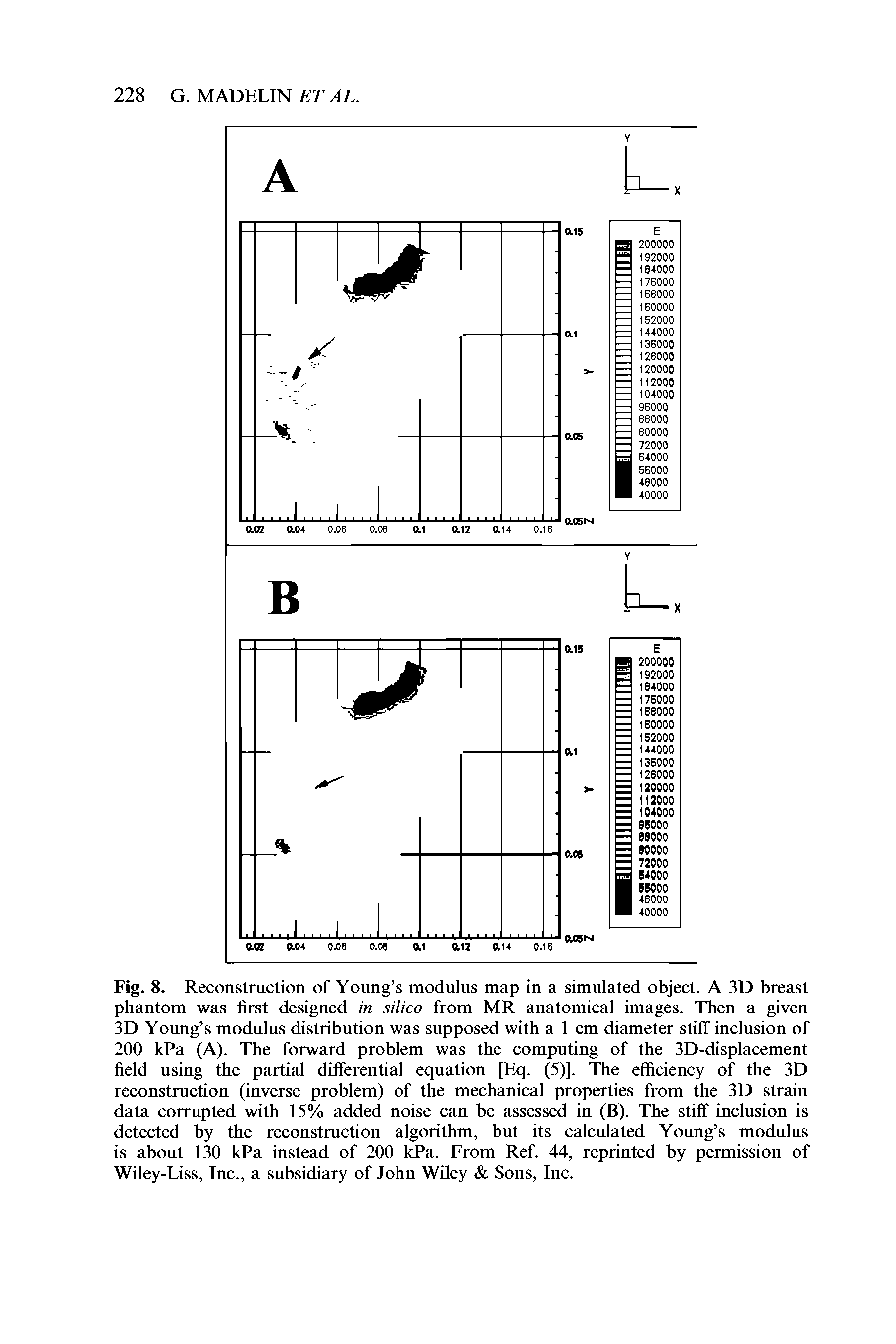 Fig. 8. Reconstruction of Young s modulus map in a simulated object. A 3D breast phantom was first designed in silico from MR anatomical images. Then a given 3D Young s modulus distribution was supposed with a 1 cm diameter stiff inclusion of 200 kPa (A). The forward problem was the computing of the 3D-displacement field using the partial differential equation [Eq. (5)]. The efficiency of the 3D reconstruction (inverse problem) of the mechanical properties from the 3D strain data corrupted with 15% added noise can be assessed in (B). The stiff inclusion is detected by the reconstruction algorithm, but its calculated Young s modulus is about 130 kPa instead of 200 kPa. From Ref. 44, reprinted by permission of Wiley-Liss, Inc., a subsidiary of John Wiley Sons, Inc.