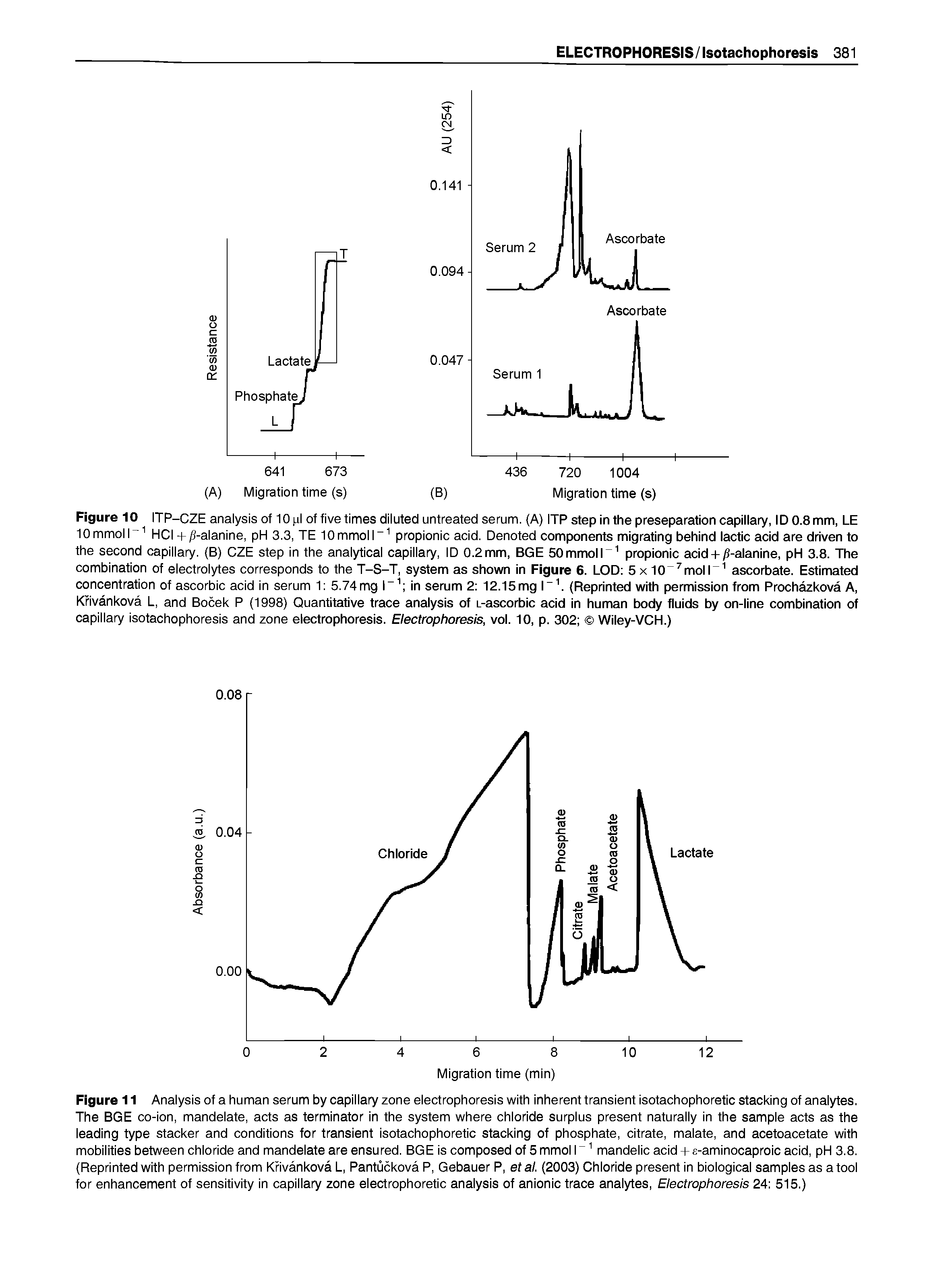 Figure 11 Analysis of a human serum by capillary zone electrophoresis with inherent transient isotachophoretic stacking of analytes. The BGE co-ion, mandelate, acts as terminator in the system where chloride surplus present naturally in the sample acts as the leading type stacker and conditions for transient isotachophoretic stacking of phosphate, citrate, malate, and acetoacetate with mobilities between chloride and mandelate are ensured. BGE is composed of 5 mmol r mandelic acid-h e-aminocaproic acid, pH 3.8. Reprinted with permission from Kfivankova L, Pantuckova P, Gebauer P, et al. (2003) Chloride present in biological samples as a tool for enhancement of sensitivity in capillary zone electrophoretic analysis of anionic trace analytes. Electrophoresis 24 515.)...