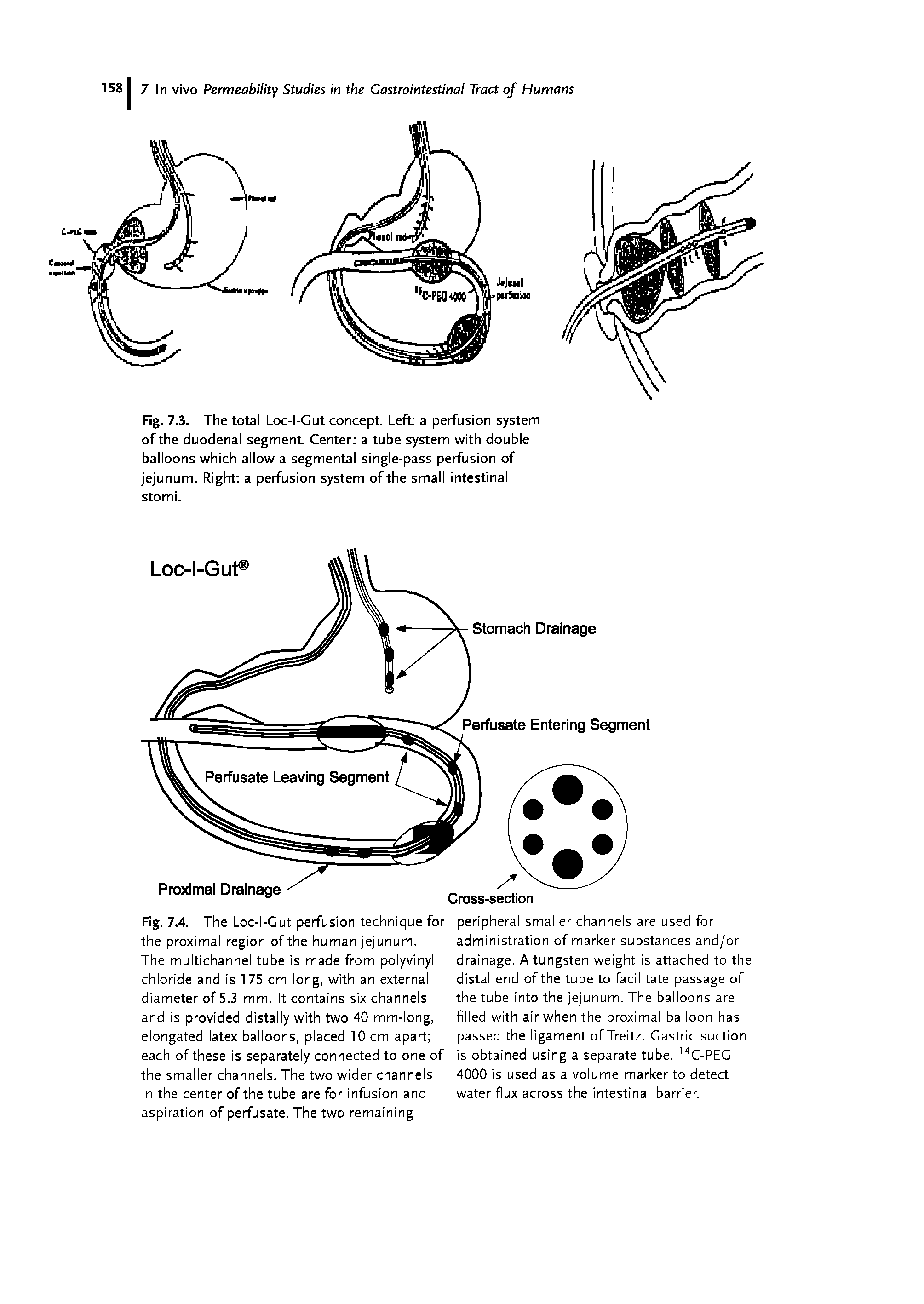 Fig. 7.4. The Loc-I-Cut perfusion technique for the proximal region of the human jejunum.