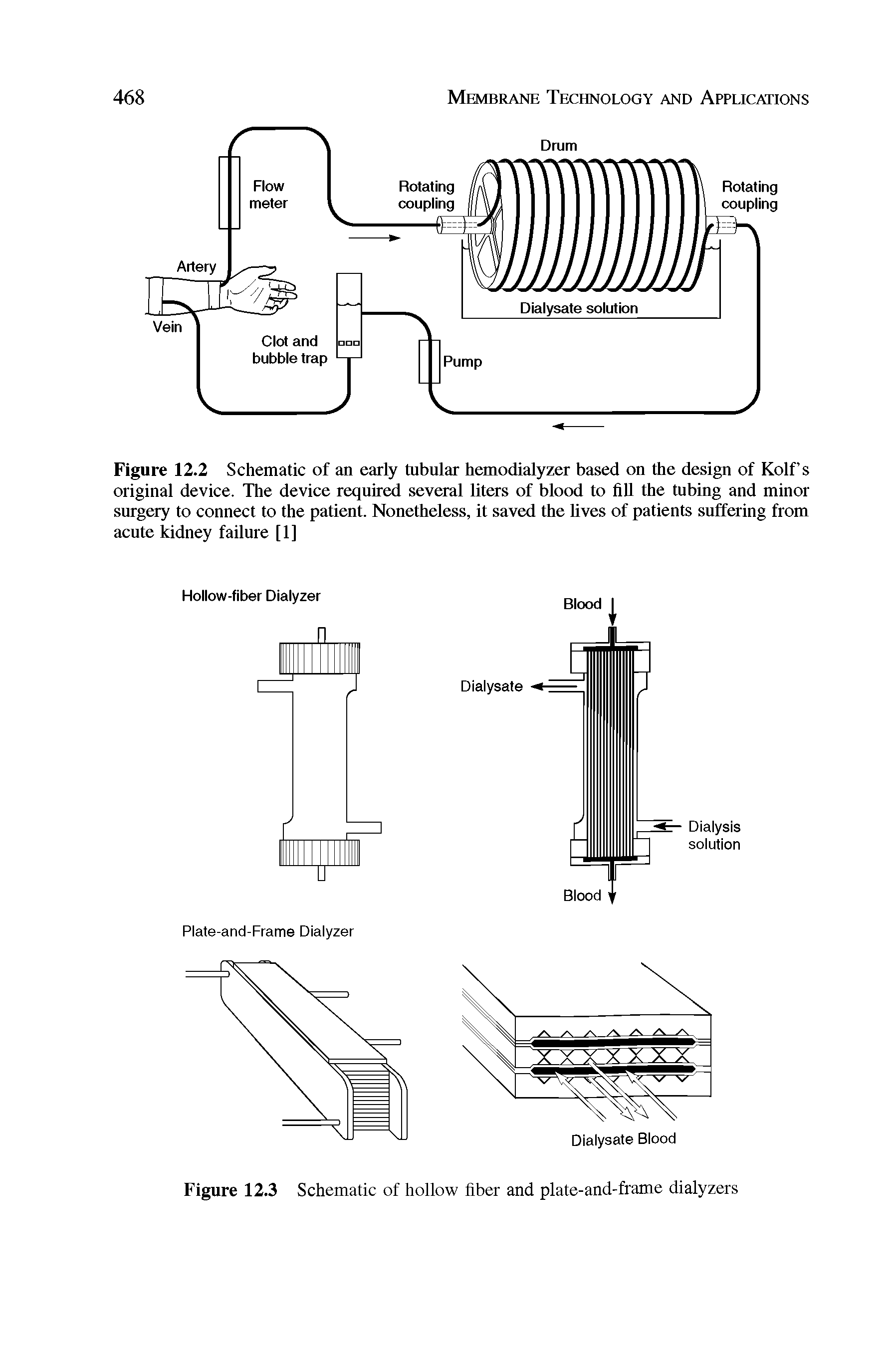 Figure 12.2 Schematic of an early tubular hemodialyzer based on the design of Kolf s original device. The device required several liters of blood to fill the tubing and minor surgery to connect to the patient. Nonetheless, it saved the lives of patients suffering from acute kidney failure [1]...