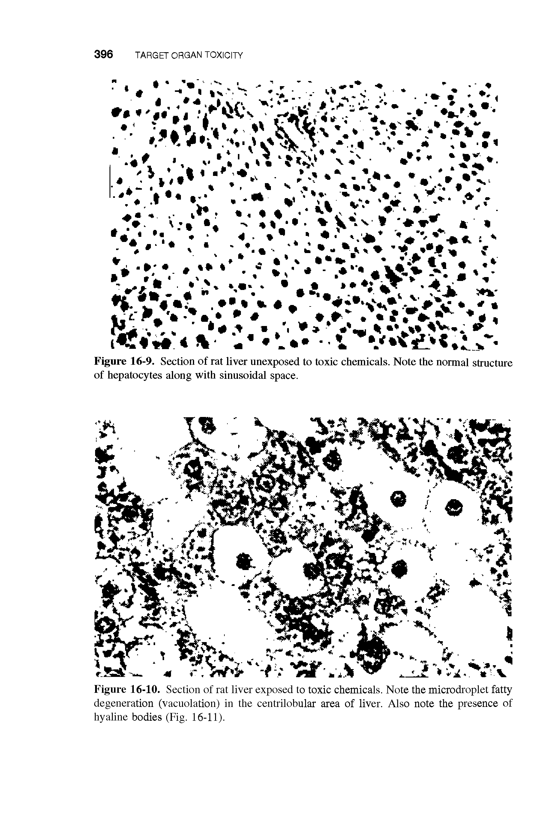 Figure 16-10. Section of rat liver exposed to toxic chemicals. Note the microdroplet fatty degeneration (vacuolation) in the centrilobular area of liver. Also note the presence of hyaline bodies (Fig. 16-11).
