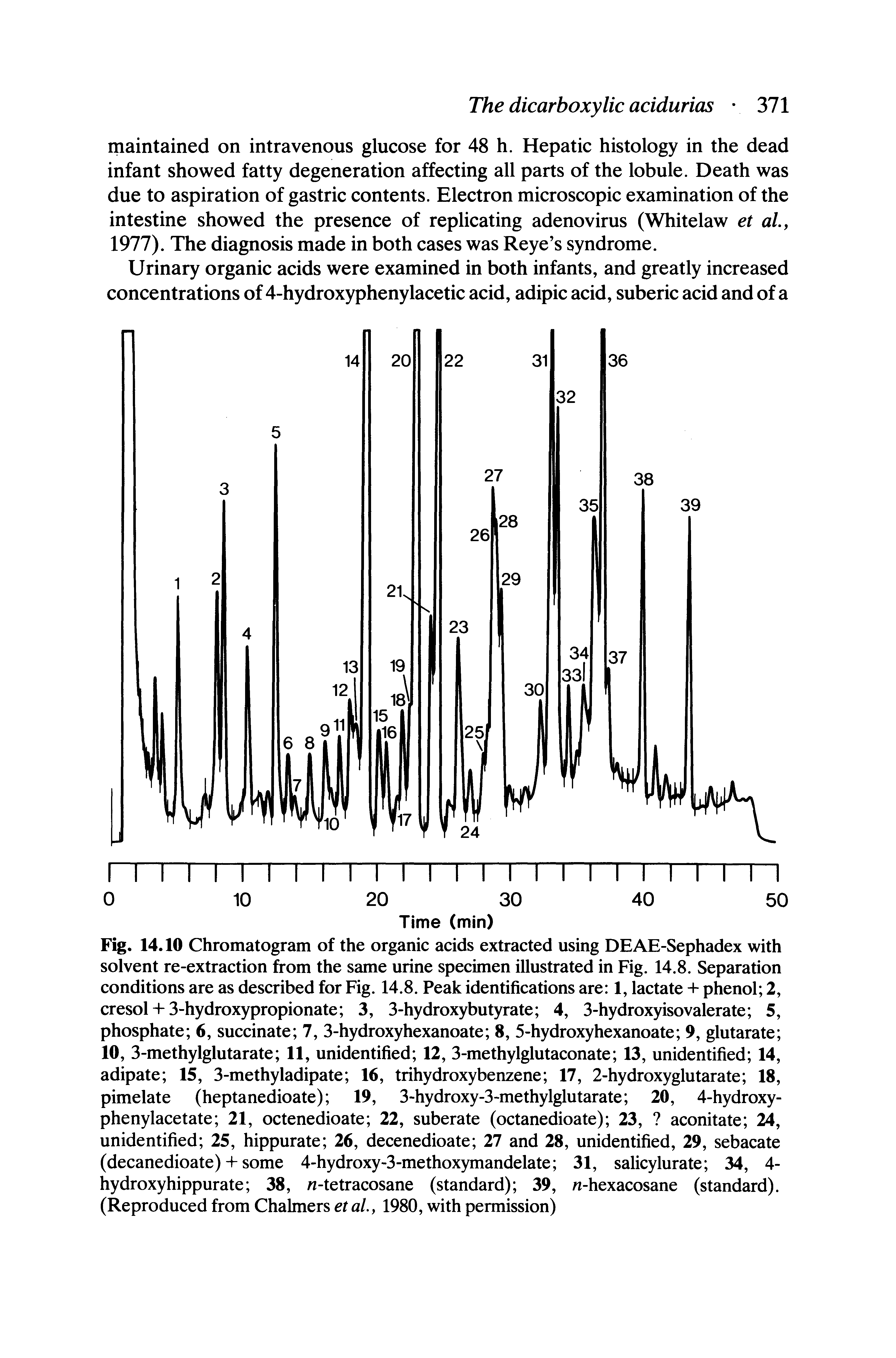Fig. 14.10 Chromatogram of the organic acids extracted using DEAE-Sephadex with solvent re-extraction from the same urine specimen illustrated in Fig. 14.8. Separation conditions are as described for Fig. 14.8. Peak identifications are 1, lactate + phenol 2, cresol + 3-hydroxypropionate 3, 3-hydroxybutyrate 4, 3-hydroxyisovalerate 5, phosphate 6, succinate 7, 3-hydroxyhexanoate 8, 5-hydroxyhexanoate 9, glutarate 10, 3-methylglutarate 11, unidentified 12, 3-methylglutaconate 13, unidentified 14, adipate 15, 3-methyladipate 16, trihydroxybenzene 17, 2-hydroxyglutarate 18, pimelate (heptanedioate) 19, 3-hydroxy-3-methylglutarate 20, 4-hydroxy-...