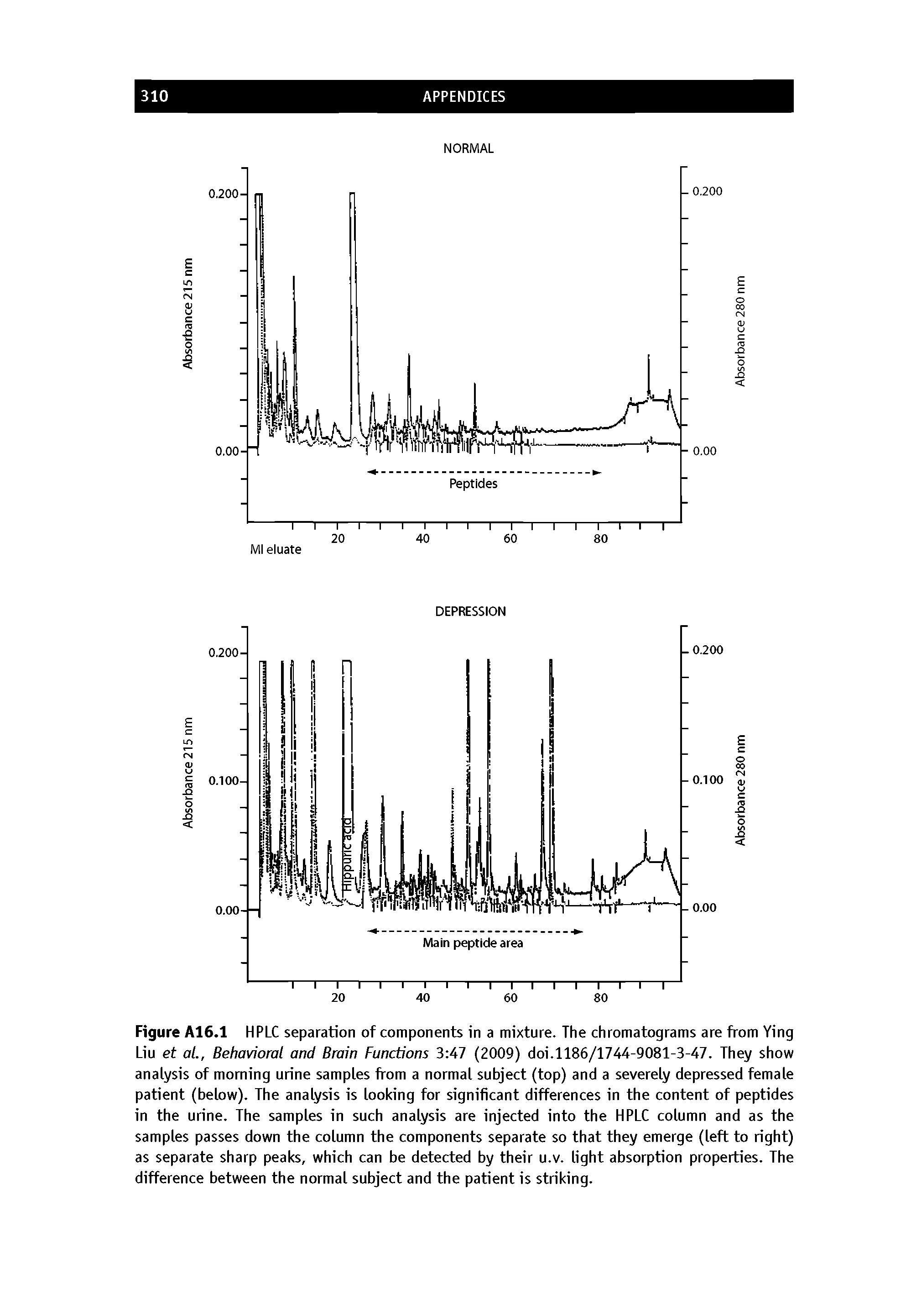 Figure A16.1 HPLC separation of components in a mixture. The chromatograms are from Ying Liu et al.. Behavioral and Brain Functions 3 47 (2009) doi.1186/1744-9081-3-47. They show analysis of morning urine samples from a normal subject (top) and a severely depressed female patient (below). The analysis is looking for significant differences in the content of peptides in the urine. The samples in such analysis are injected into the HPLC column and as the samples passes down the column the components separate so that they emerge (left to right) as separate sharp peaks, which can be detected by their u.v. light absorption properties. The difference between the normal subject and the patient is striking.