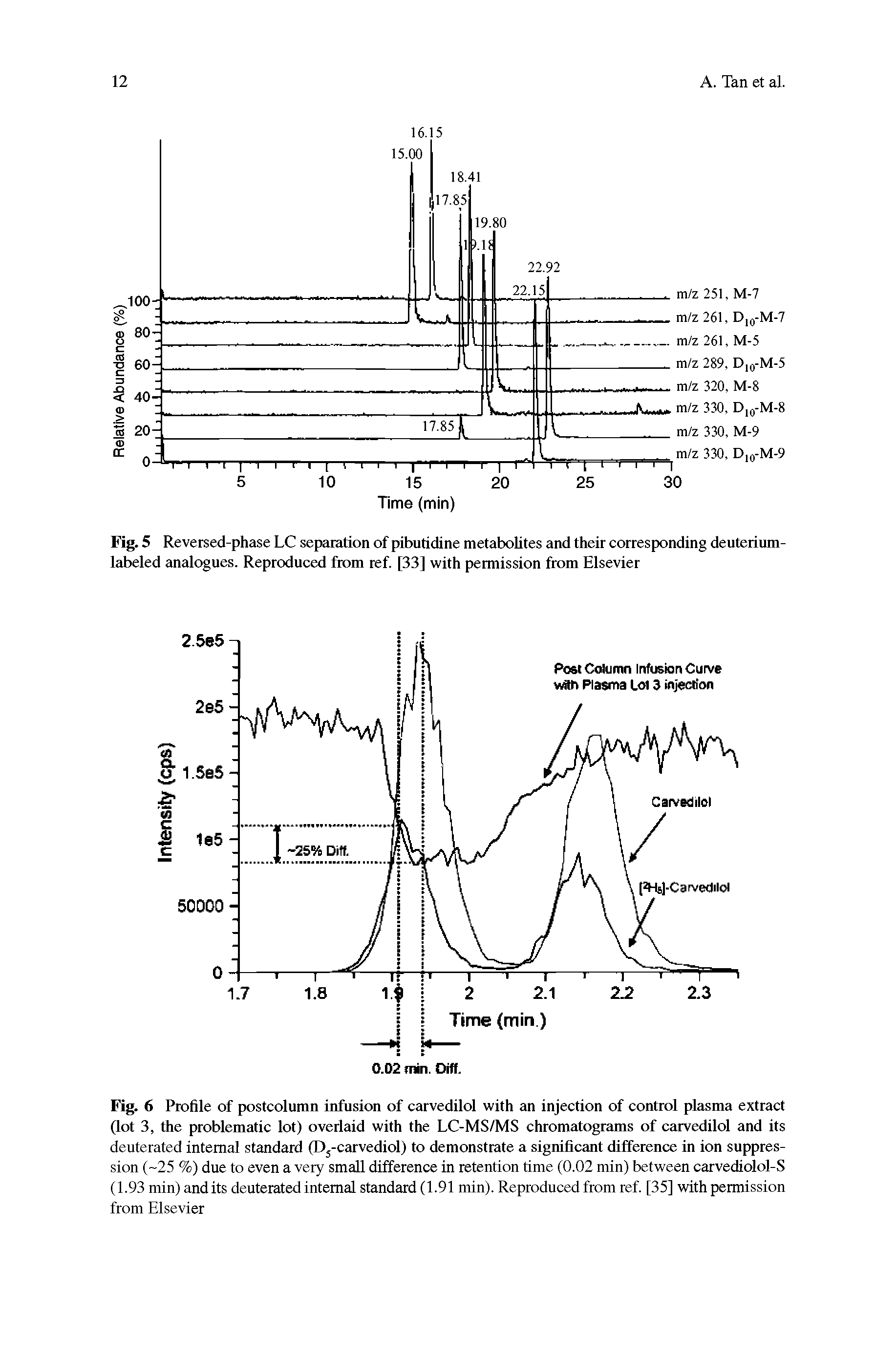 Fig. 6 Profile of postcolumn infusion of carvedilol with an injection of control plasma extract (lot 3, the problematic lot) overlaid with the LC-MS/MS chromatograms of carvedilol and its deuterated internal standard (D5-carvediol) to demonstrate a significant difference in ion suppression (-25 %) due to even a very small difference in retention time (0.02 min) between carvediolol-S (1.93 min) and its deuterated internal standard (1.91 min). Reproduced from ref. [35] with permission from Elsevier...