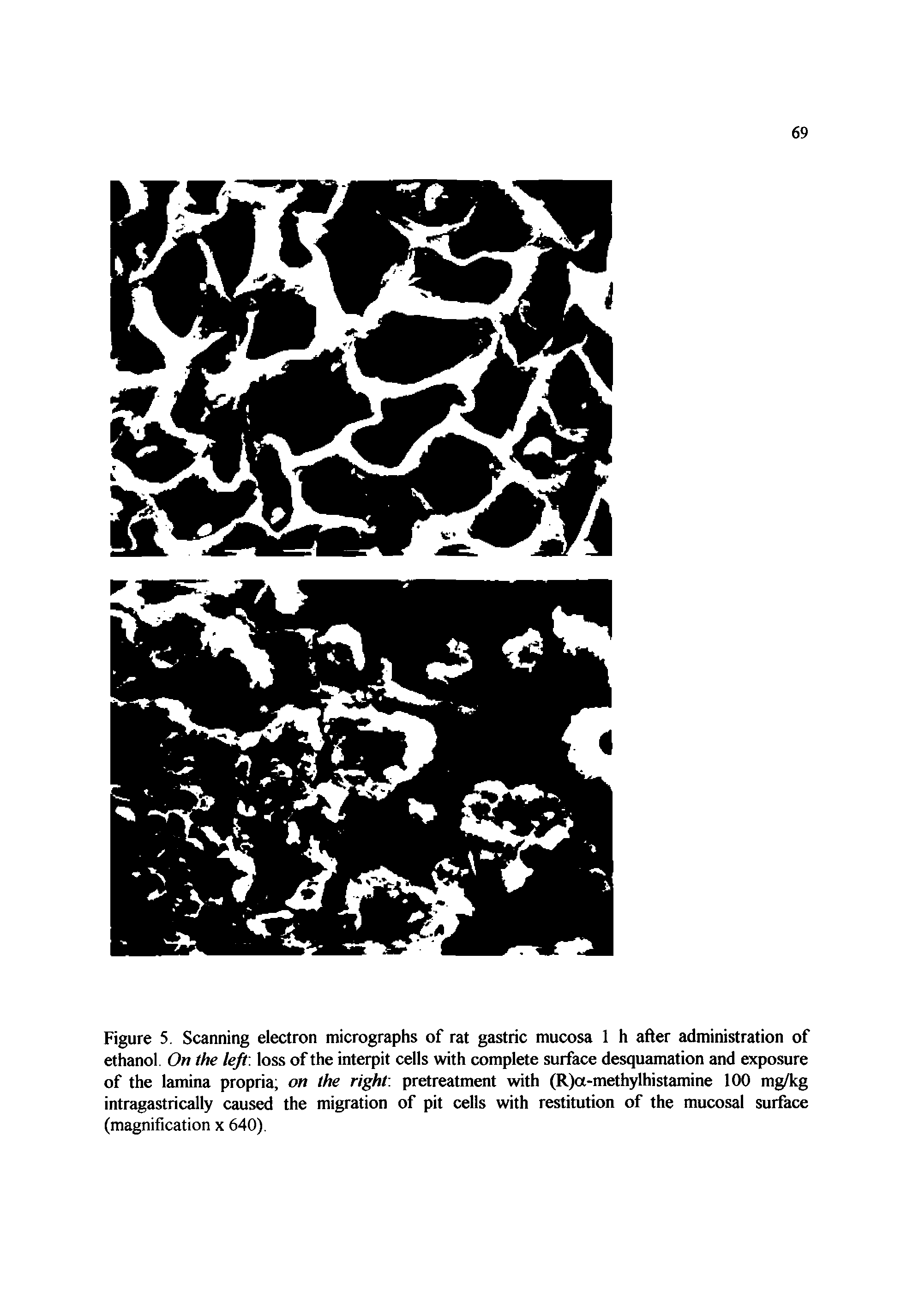 Figure 5. Scanning electron micrographs of rat gastric mucosa 1 h after administration of ethanol On the left, loss of the interpit cells with complete surface desquamation and exposure of the lamina propria on the right, pretreatment with (R)a-methylhistamine 100 mg/kg intragastrically caused the migration of pit cells with restitution of the mucosal surface (magnification x 640).