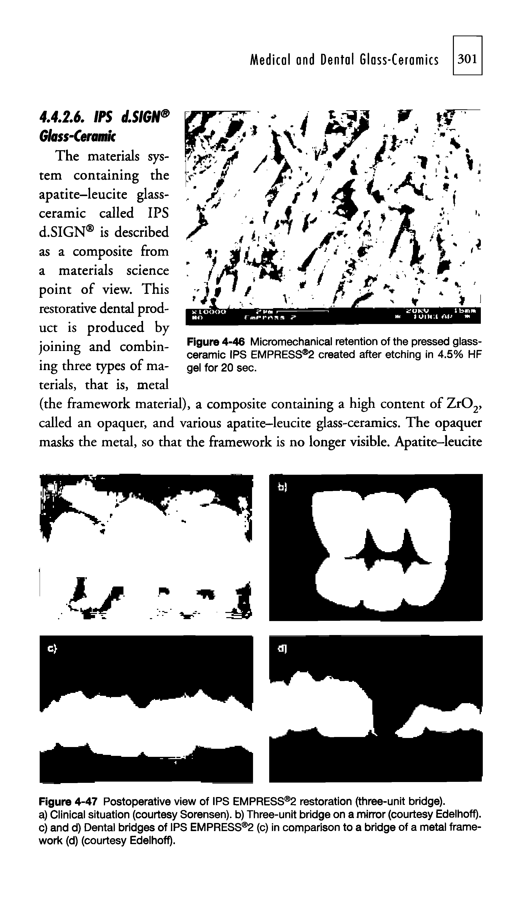 Figure 4-46 Micromechanical retention of the pressed glass-ceramic IPS EMPRESS 2 created after etching in 4.5% HF gel for 20 sec.