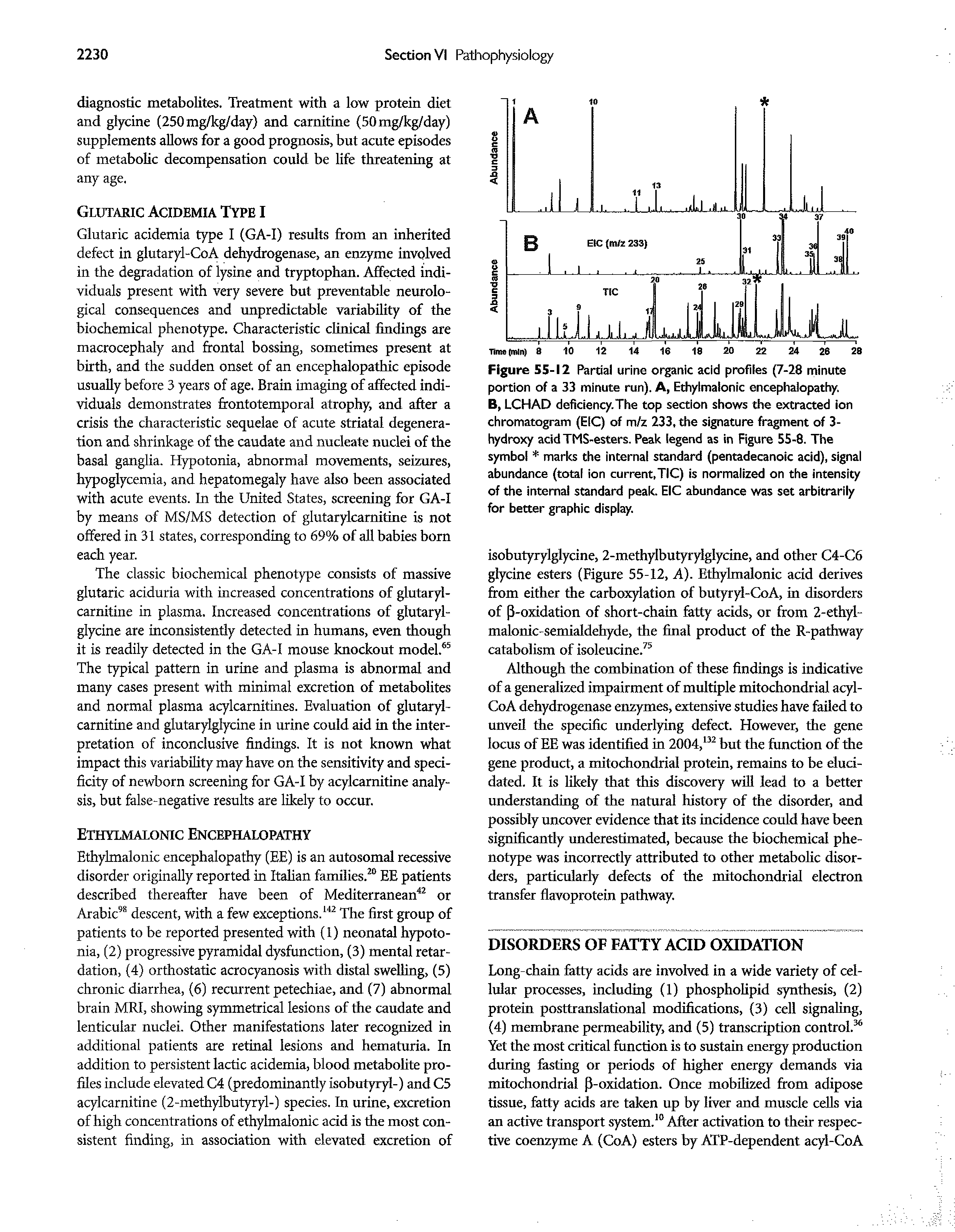 Figure 55-12 Partial urine organic acid profiles (7-28 minute portion of a 33 minute run). A, Ethylmalonic encephalopathy.