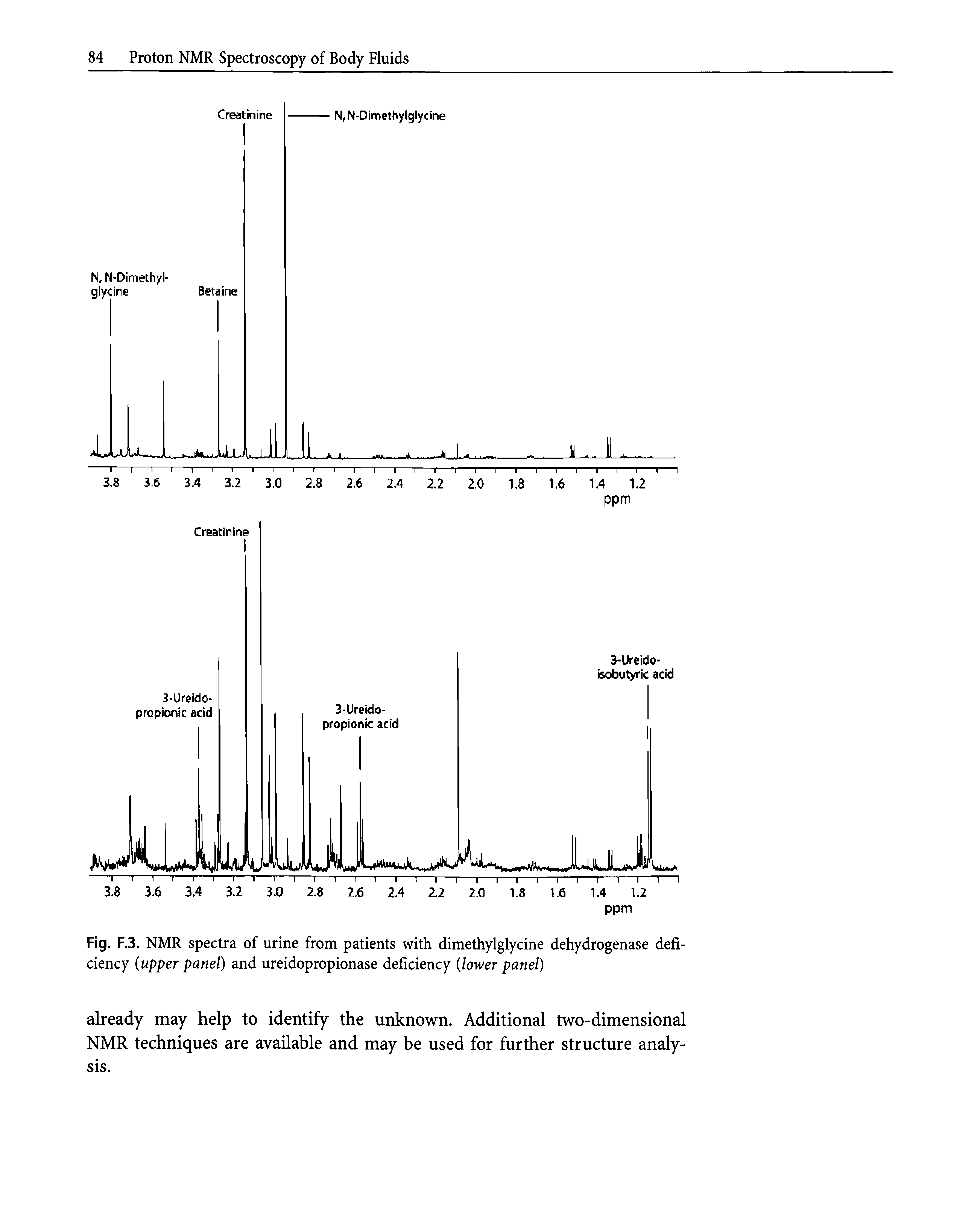 Fig. F.3. NMR spectra of urine from patients with dimethylglycine dehydrogenase deficiency (upper panel) and ureidopropionase deficiency (lower panel)...