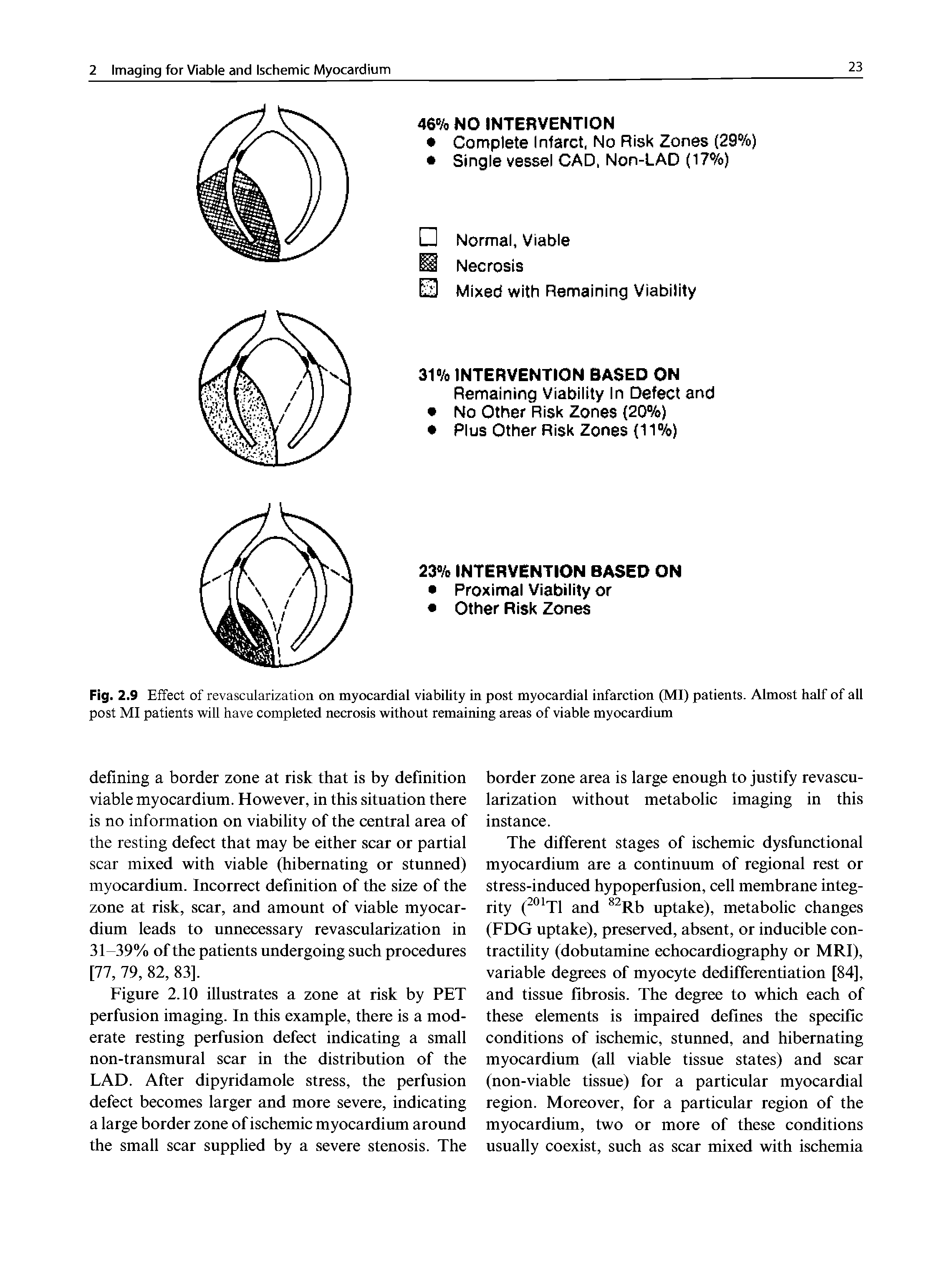 Fig. 2.9 Effect of revascularization on myocardial viability in post myocardial infarction (MI) patients. Almost half of all post MI patients will have completed necrosis without remaining areas of viable myocardium...