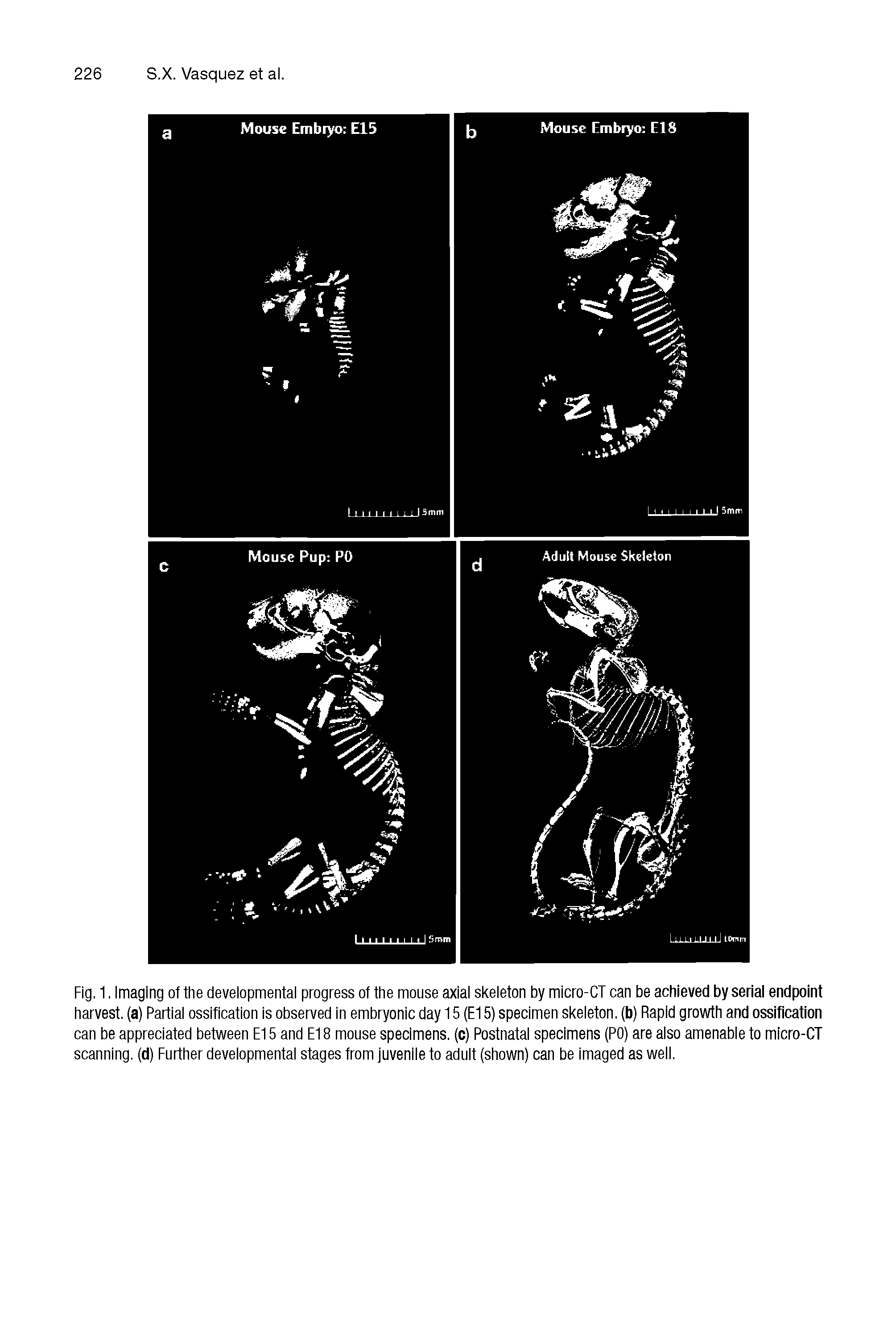Fig. 1. Imaging of the developmental progress of the mouse axial skeleton by micro-CT can be achieved by serial endpoint harvest, (a) Partial ossification is observed in embryonic day 15 (El 5) specimen skeleton, (b) Rapid growth and ossification can be appreciated between E15 and Et 8 mouse specimens, (c) Postnatal specimens (PO) are also amenable to micro-CT scanning, (d) Eurther developmental stages from juvenile to adult (shown) can be imaged as well.