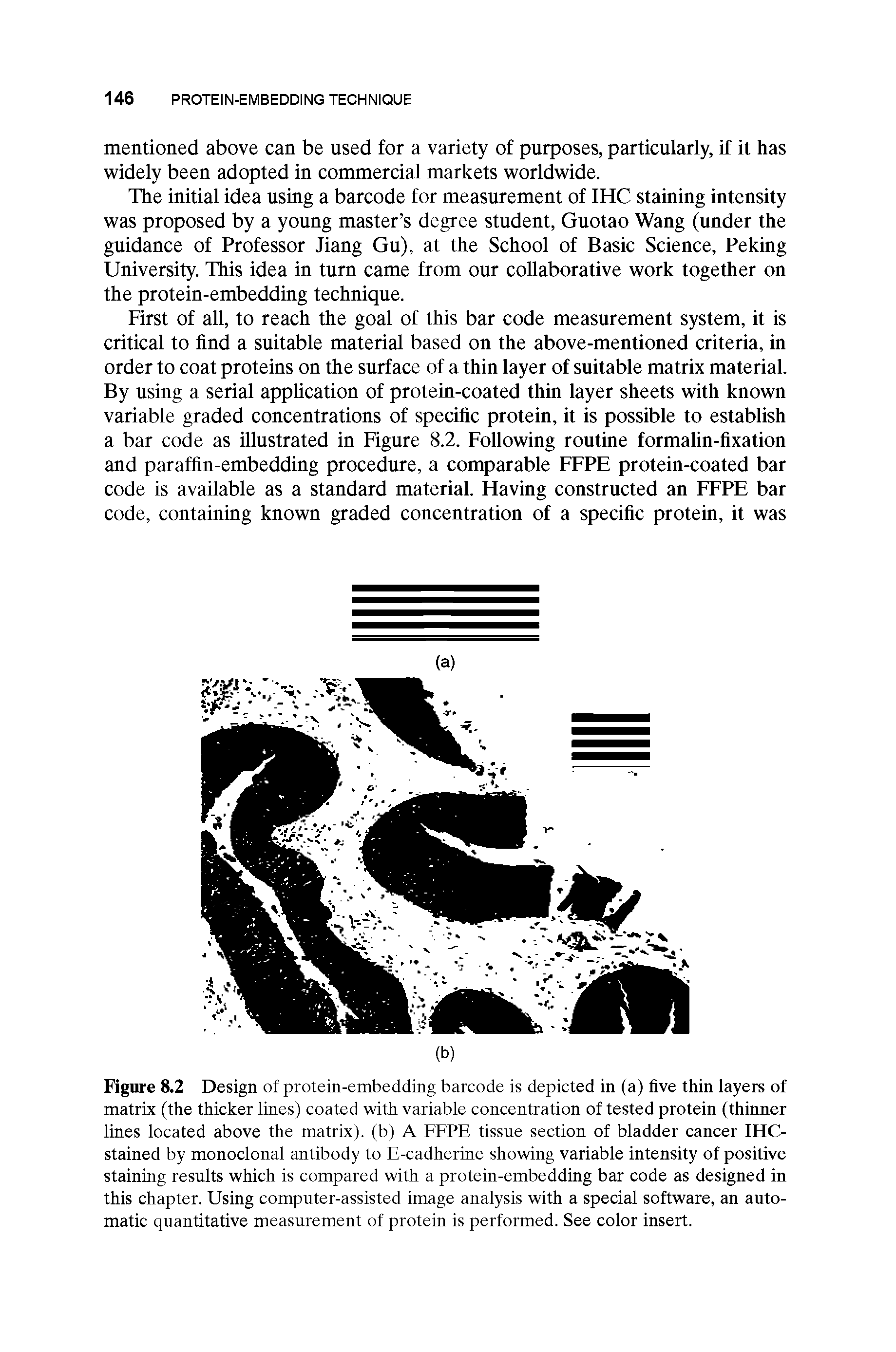 Figure 8.2 Design of protein-embedding barcode is depicted in (a) five thin layers of matrix (the thicker lines) coated with variable concentration of tested protein (thinner lines located above the matrix), (b) A FFPE tissue section of bladder cancer IHC-stained by monoclonal antibody to E-cadherine showing variable intensity of positive staining results which is compared with a protein-embedding bar code as designed in this chapter. Using computer-assisted image analysis with a special software, an automatic quantitative measurement of protein is performed. See color insert.