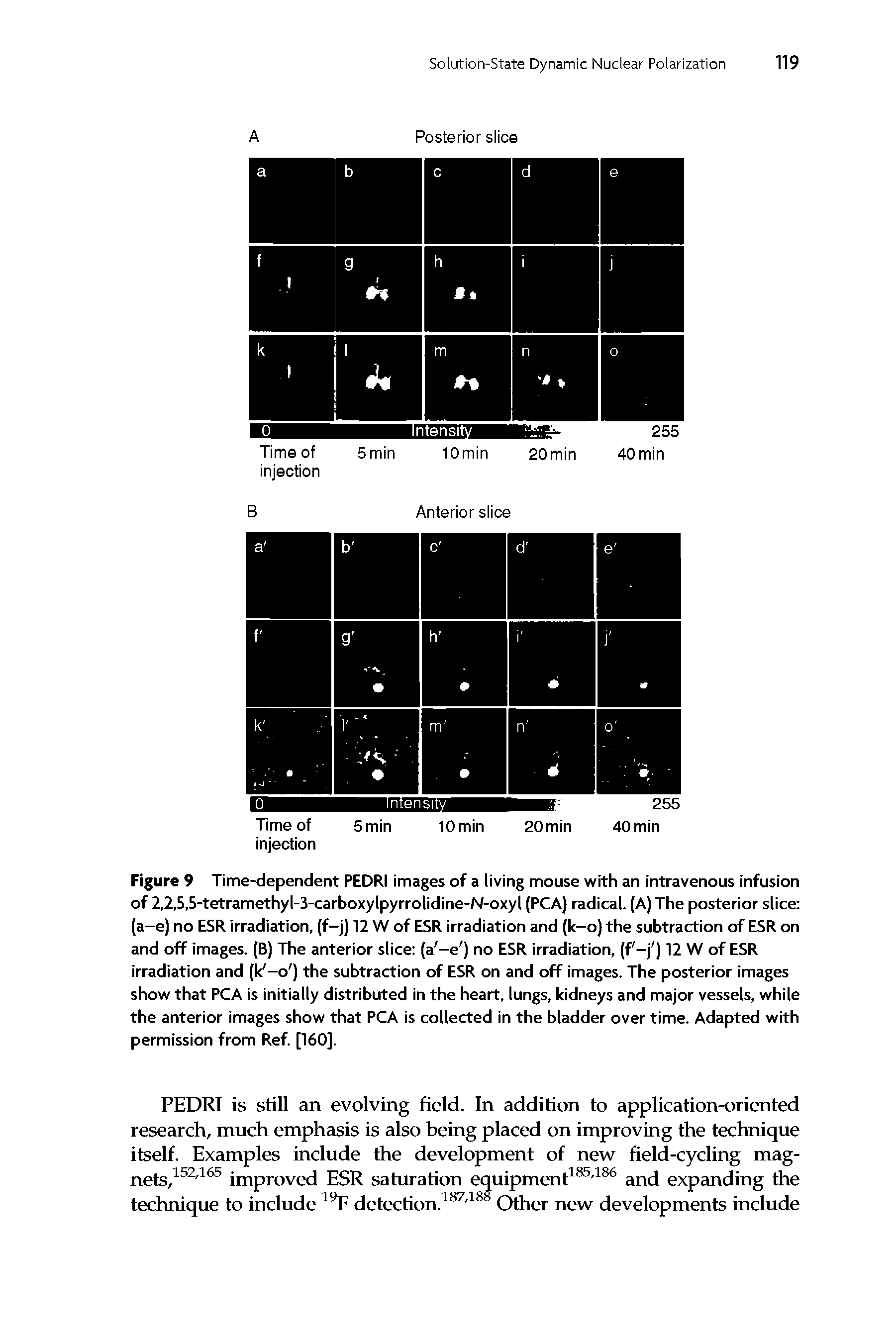 Figure 9 Time-dependent PEDRI images of a living mouse with an intravenous infusion of 2,2,5,5-tetramethyl-3-carboxylpyrrolidine-N-oxyl (PCA) radical. (A) The posterior slice (a-e) no ESR irradiation, (f-j) 12 W of ESR irradiation and (k-o) the subtraction of ESR on and off images. (B) The anterior slice (a -e ) no ESR irradiation, (f -j ) 12 W of ESR irradiation and (k -o ) the subtraction of ESR on and off images. The posterior images show that PCA is initially distributed in the heart, lungs, kidneys and major vessels, while the anterior images show that PCA is collected in the bladder over time. Adapted with permission from Ref. [160].