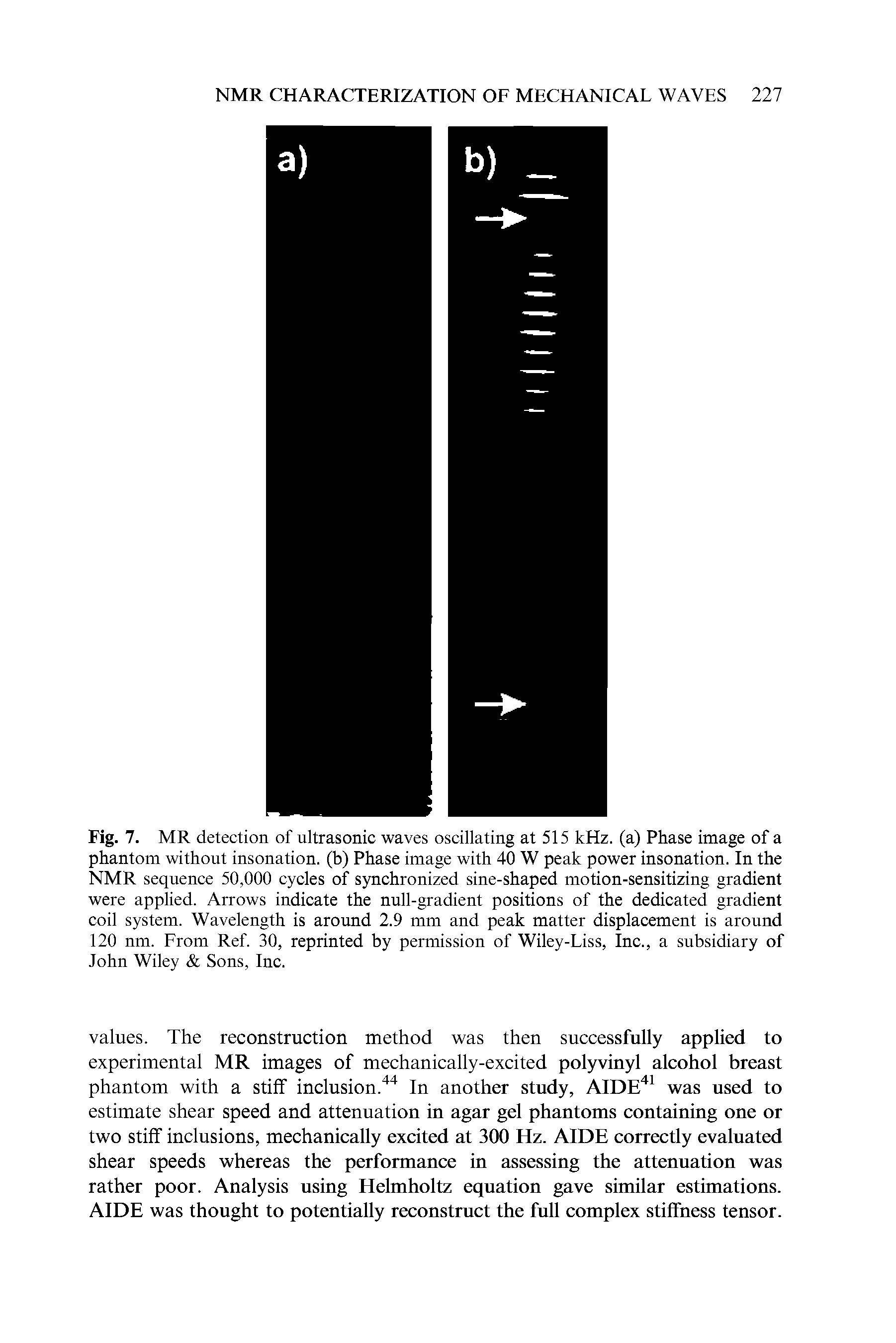 Fig. 7. MR detection of ultrasonic waves oscillating at 515 kHz. (a) Phase image of a phantom without insonation. (b) Phase image with 40 W peak power insonation. In the NMR sequence 50,000 cycles of synchronized sine-shaped motion-sensitizing gradient were applied. Arrows indicate the null-gradient positions of the dedicated gradient coil system. Wavelength is around 2.9 mm and peak matter displacement is around 120 nm. From Ref. 30, reprinted by permission of Wiley-Liss, Inc., a subsidiary of John Wiley Sons, Inc.