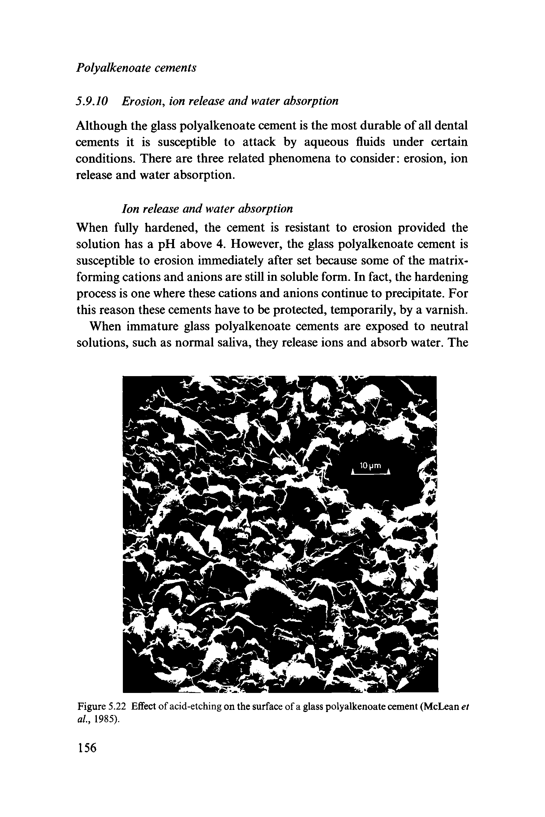 Figure 5.22 Effect of acid-etching on the surface of a glass polyalkenoate cement (McLean et al, 1985).