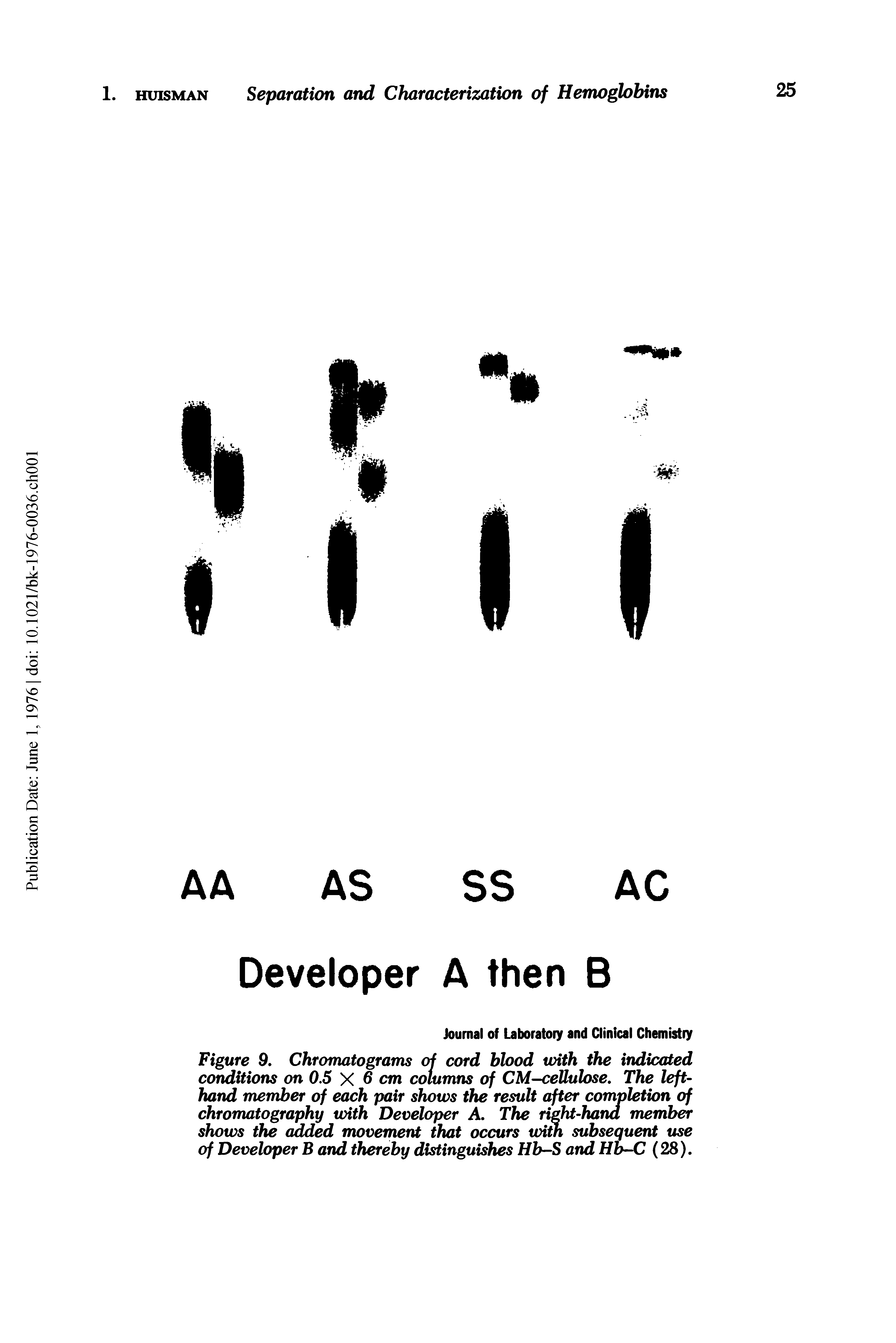 Figure 9. Chromatograms of cord blood with the indicated conditions on 0,5 X 6 cm columns of CM-ceUuhse, The left-hand member of each pair shows the result after completion of chromatography with Developer A. The right-hand member shows the added movement that occurs with subsequent use of Developer B and thereby distinguishes Hb-S and Hb-C (28).